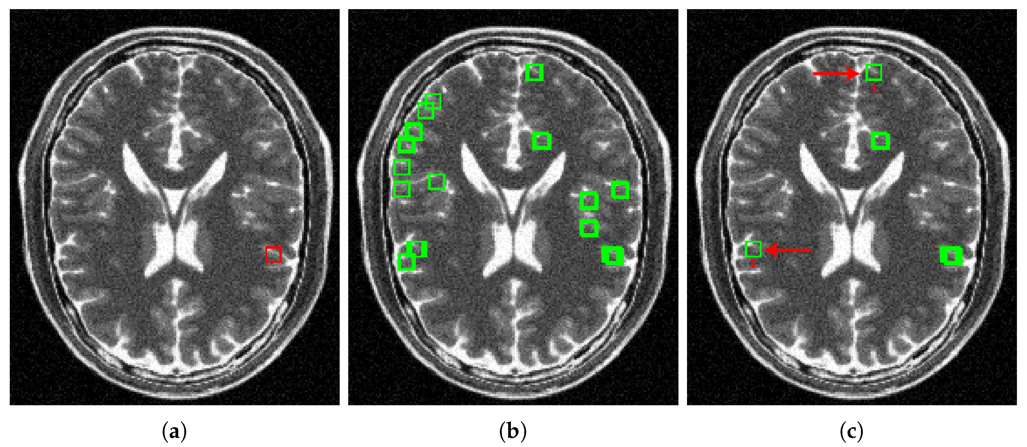 Sensors 20 01536 g003a Sensors 20 01536 g003a