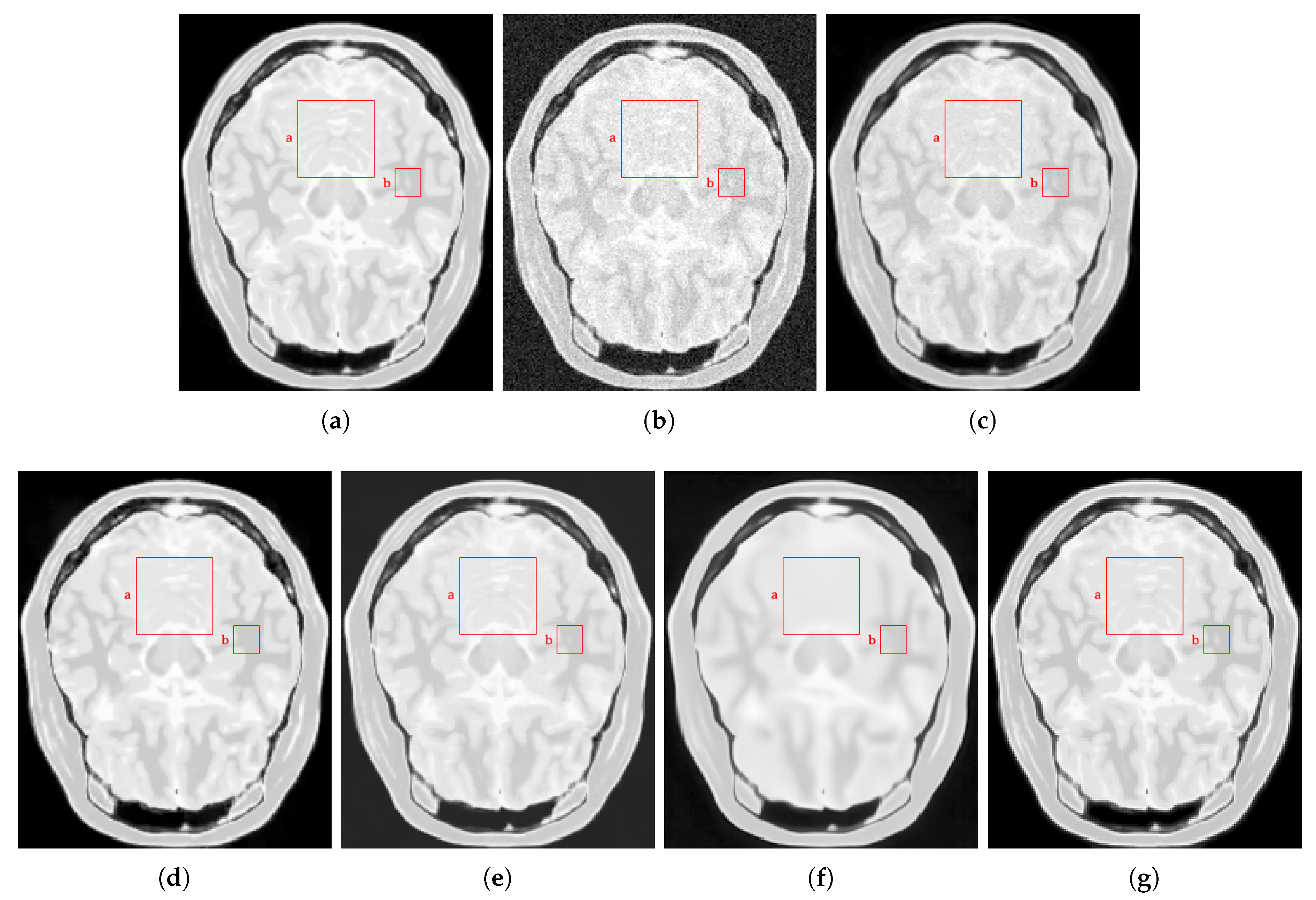 Sensors 20 01536 g015 Sensors 20 01536 g015