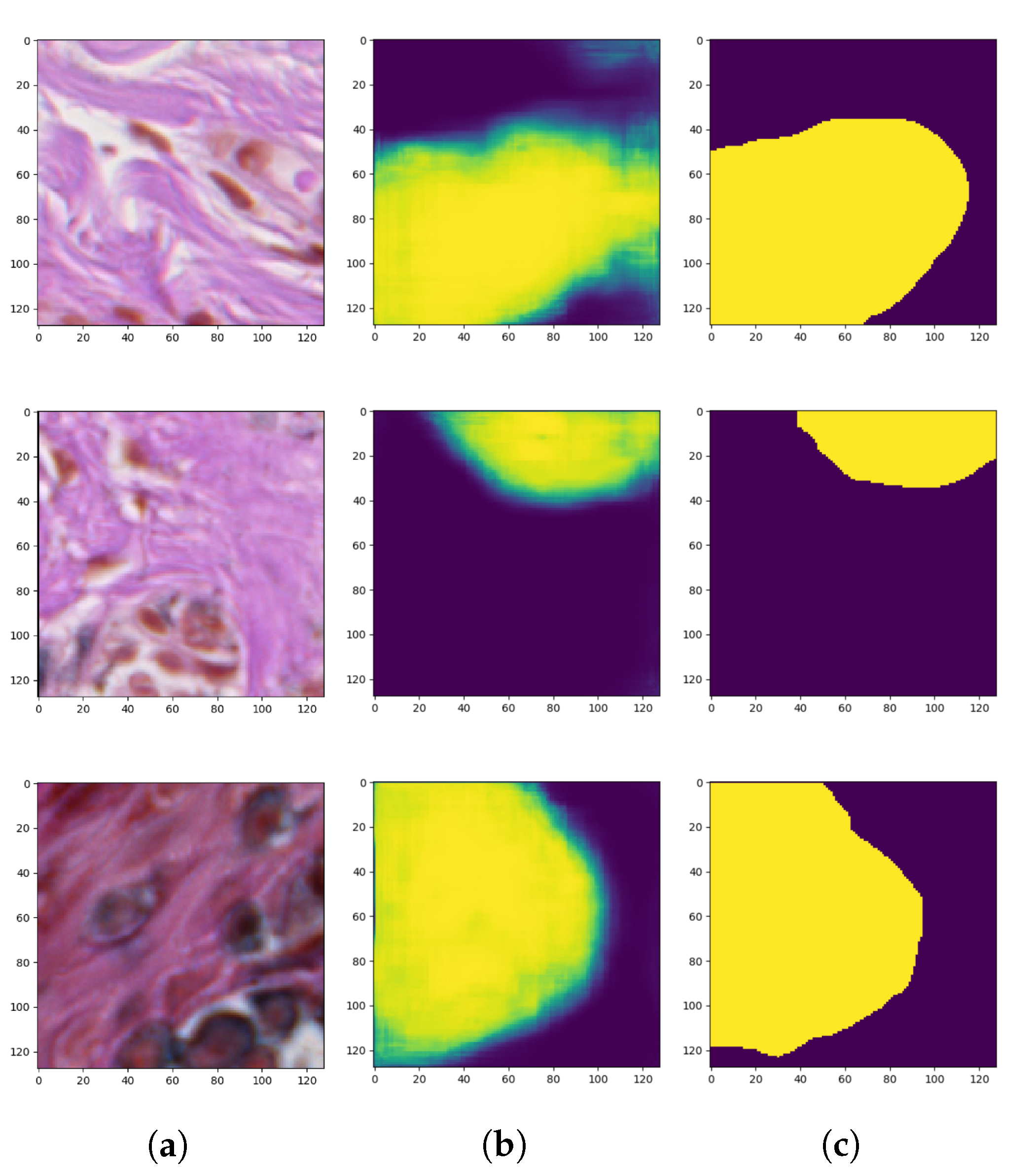 Sensors | Free Full-Text | Semi-Supervised Nests of Melanocytes ...