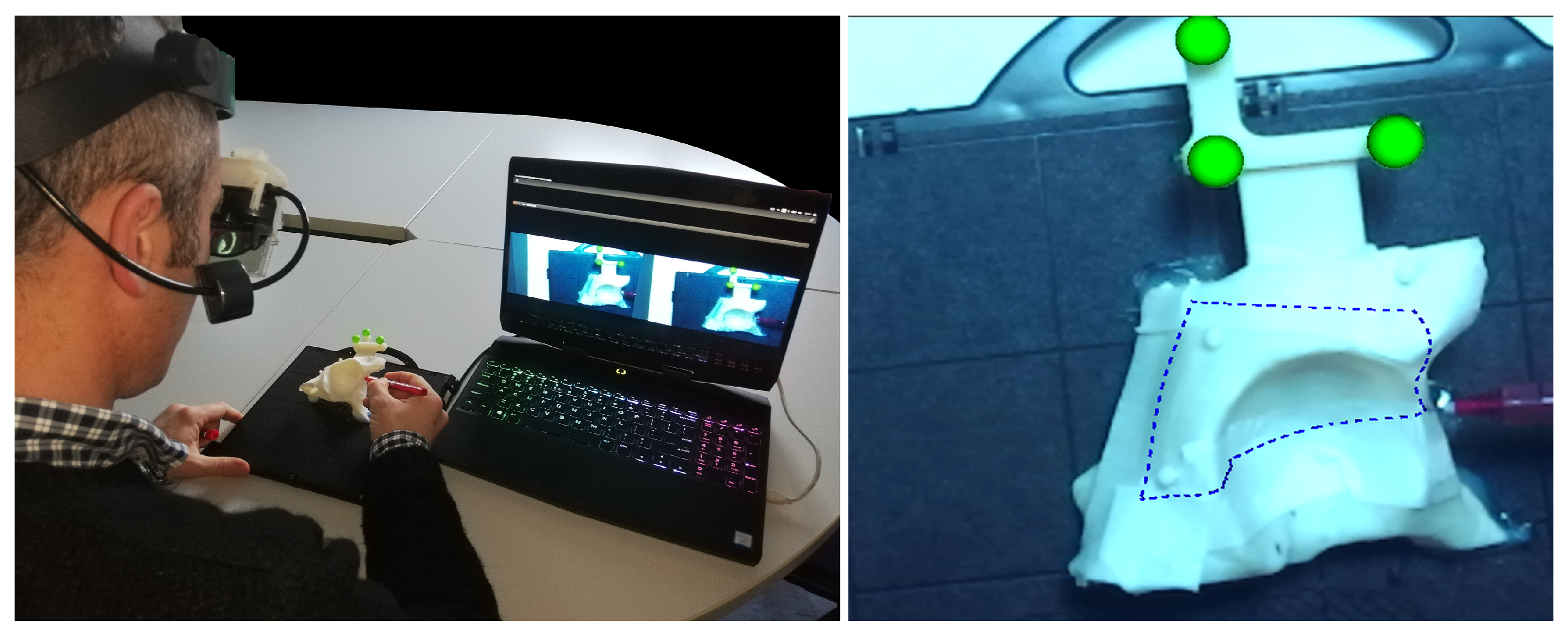 Sensors 20 01612 g003 Sensors 20 01612 g003