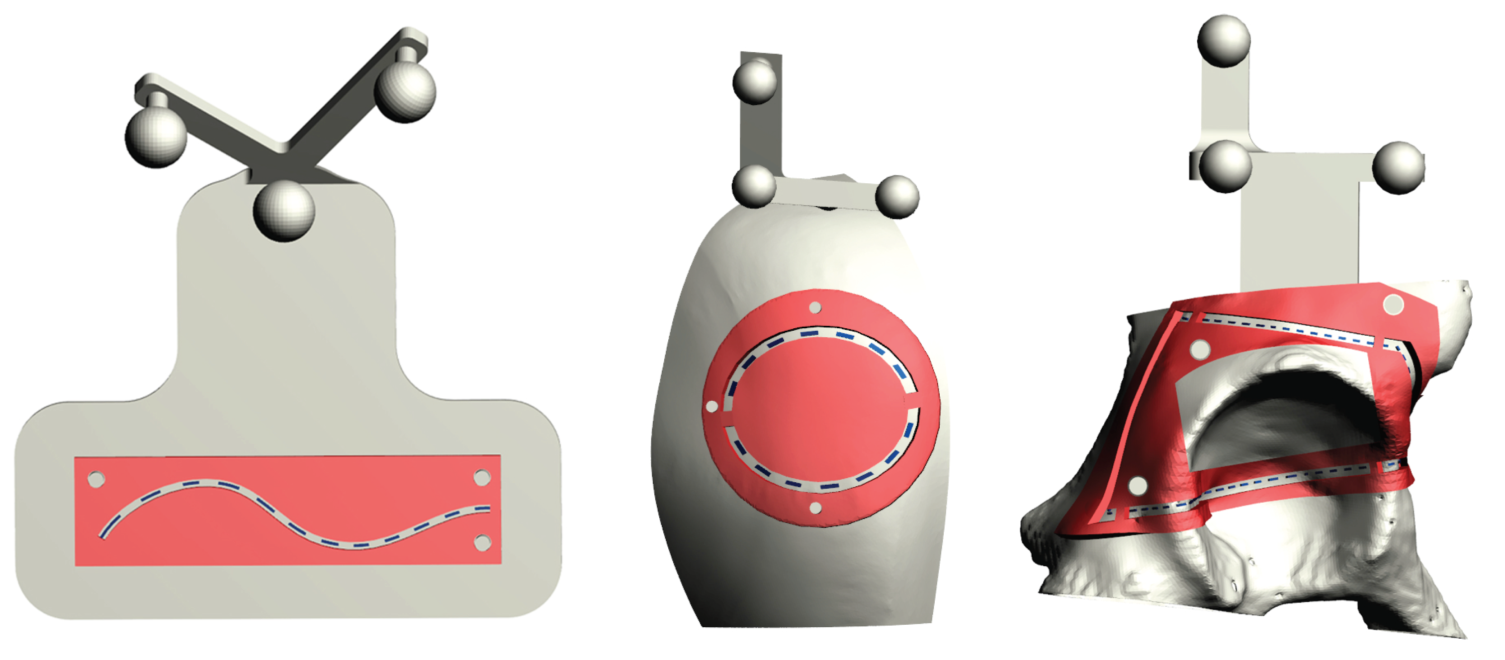 Sensors 20 01612 g004 Sensors 20 01612 g004