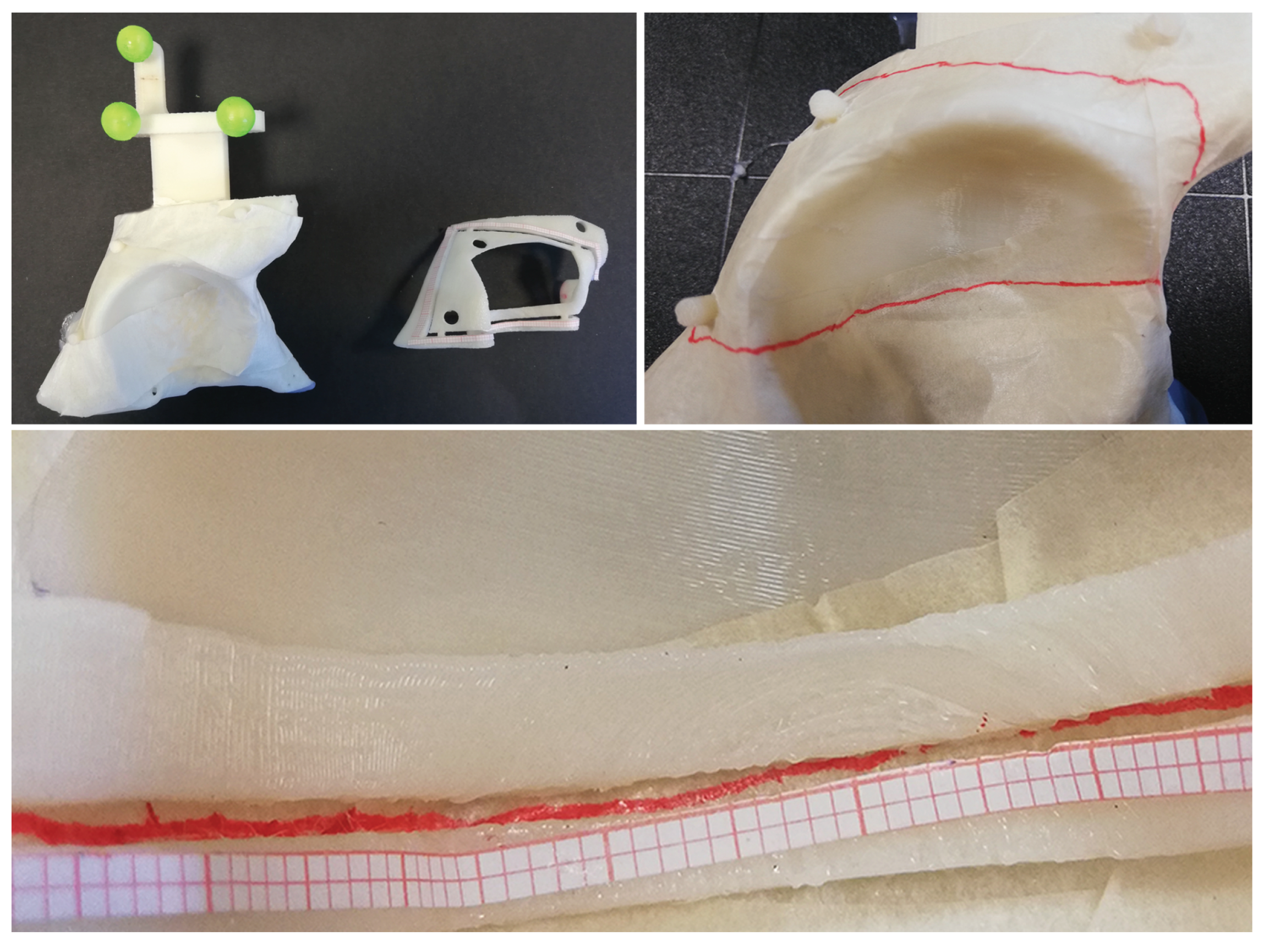 Sensors 20 01612 g006 Sensors 20 01612 g006