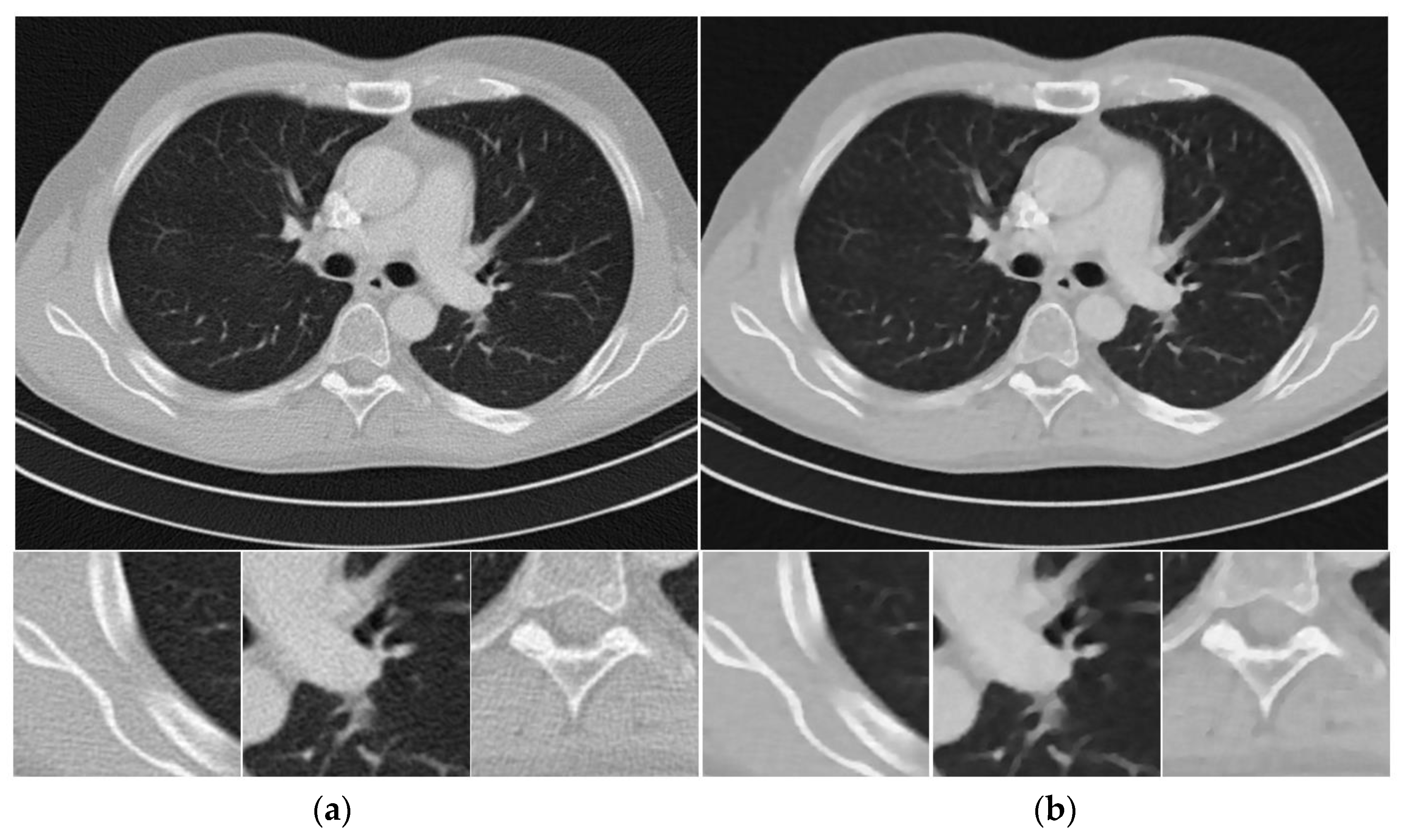 Sensors 20 01647 g004a