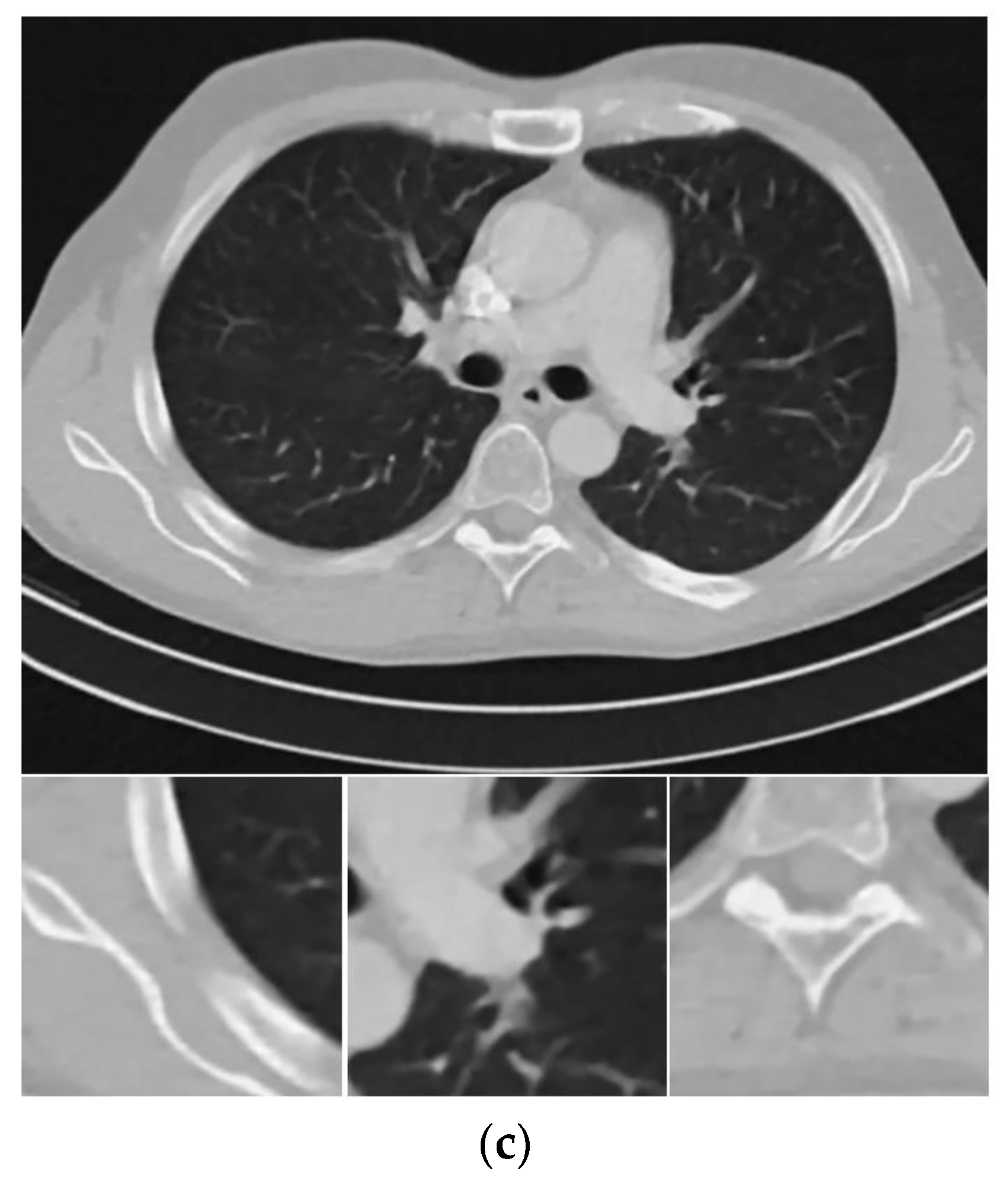 Sensors 20 01647 g004b