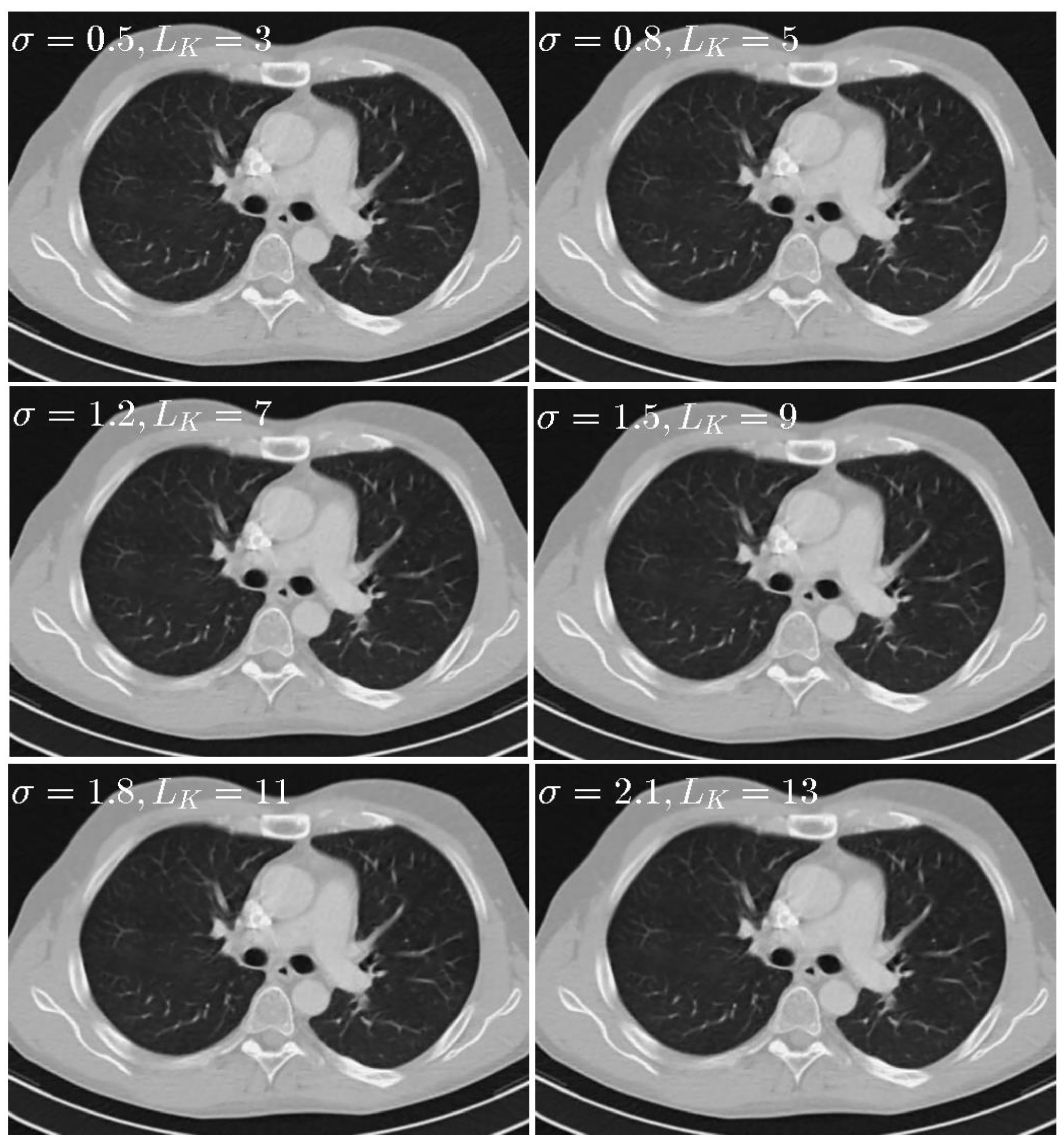 Sensors 20 01647 g008