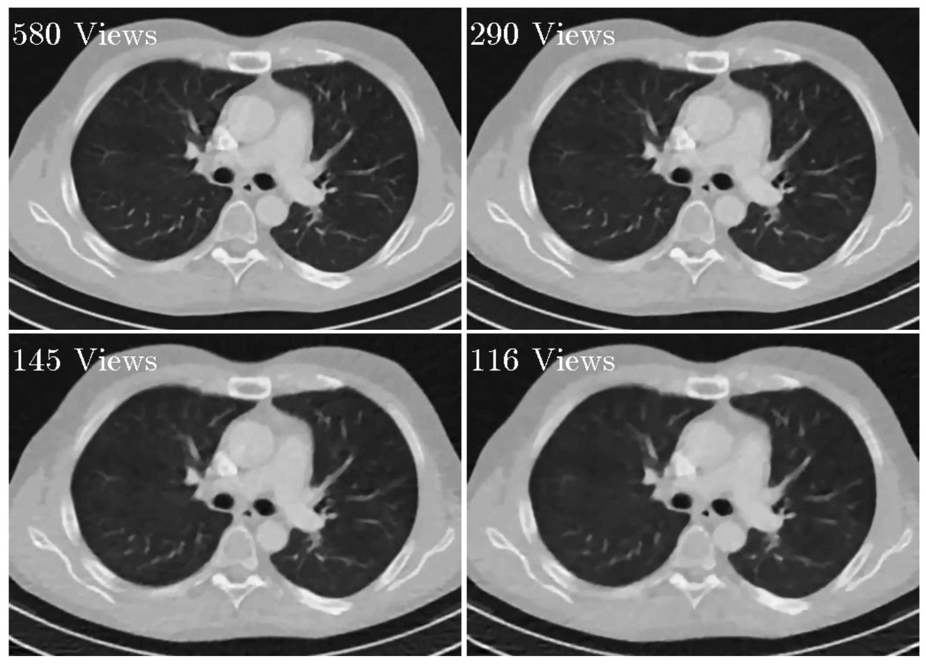 Sensors 20 01647 g009
