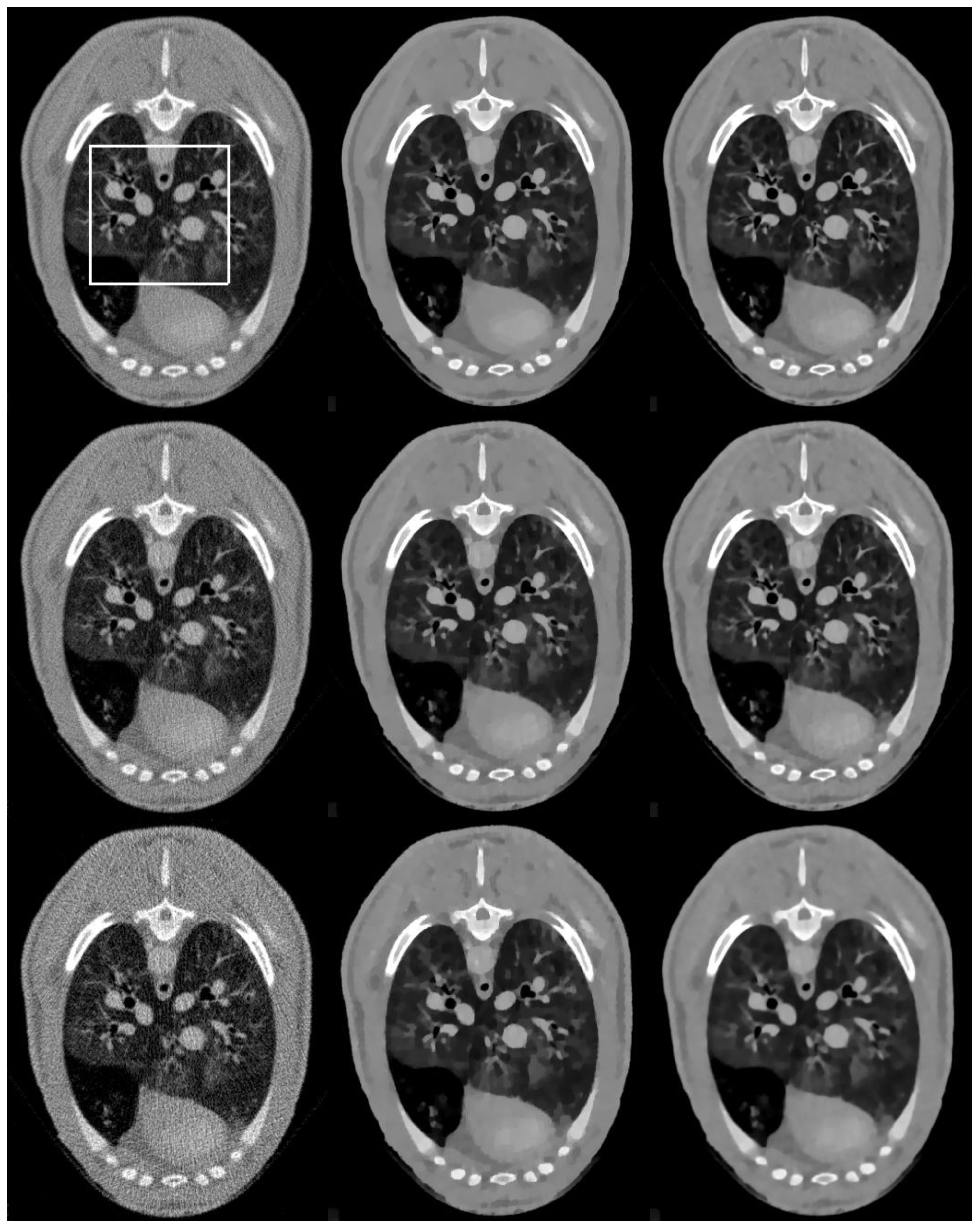 Sensors 20 01647 g010