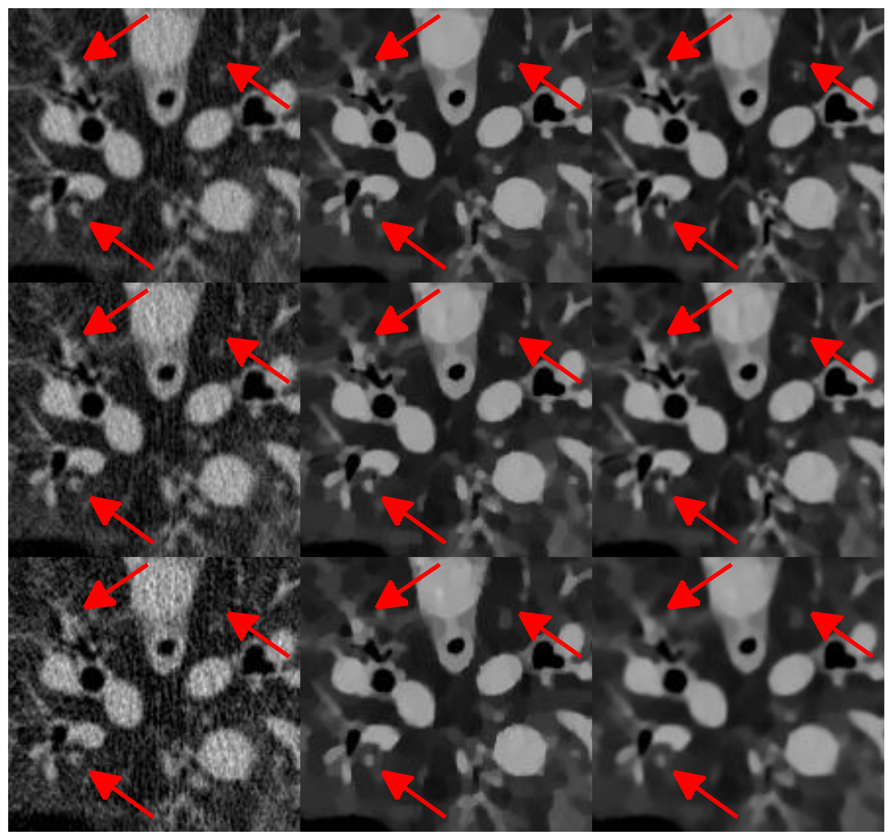 Sensors 20 01647 g011