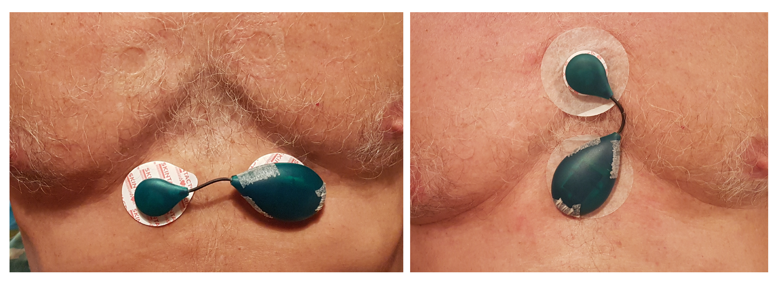 Sensors 20 01695 g006 Sensors 20 01695 g006