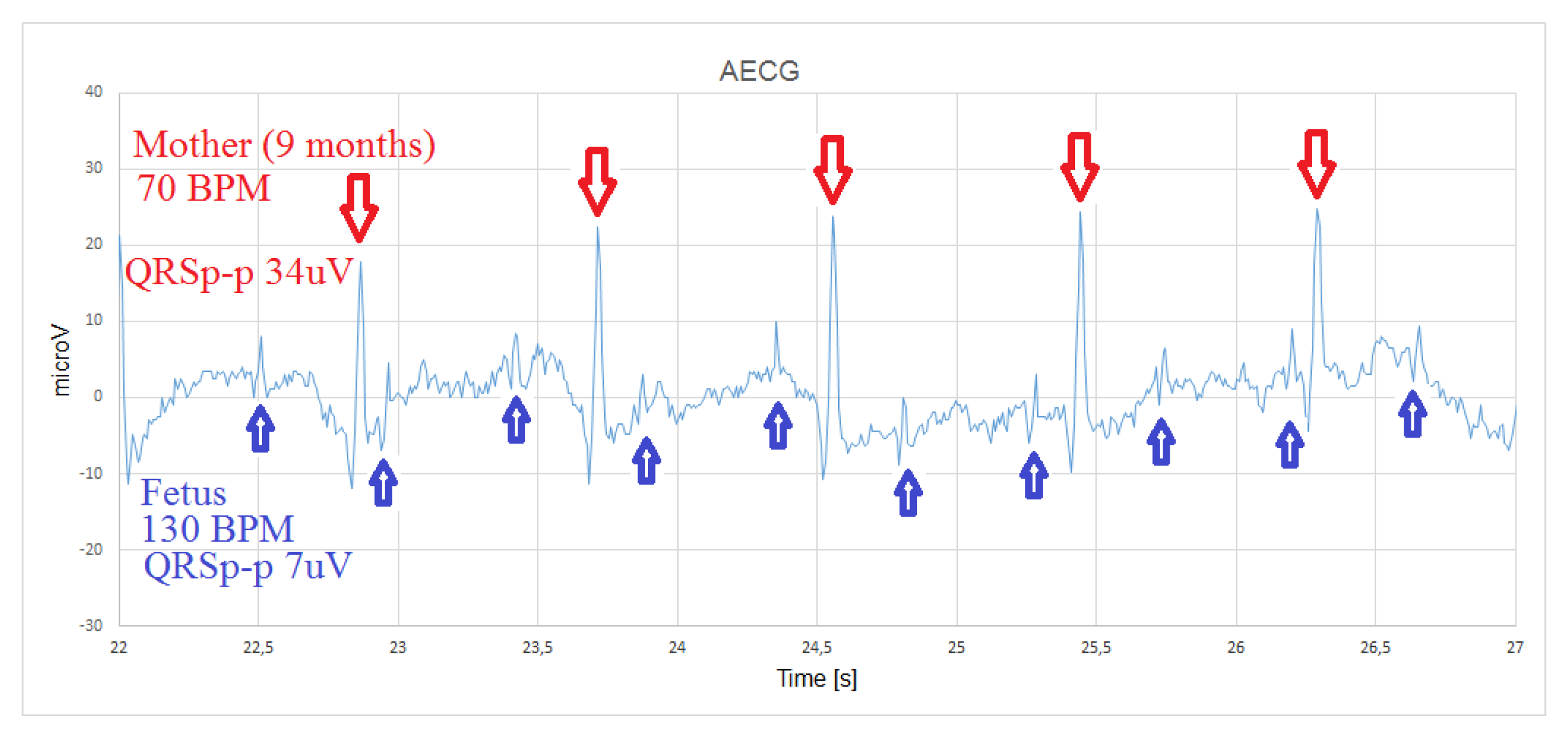Sensors 20 01695 g010 Sensors 20 01695 g010