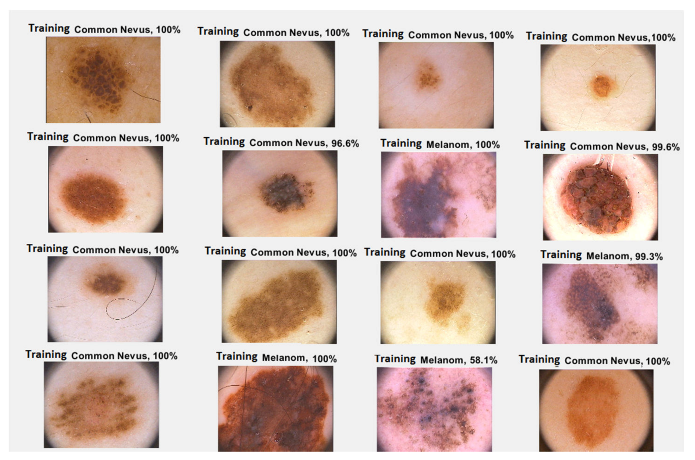 Sensors 20 01753 g017