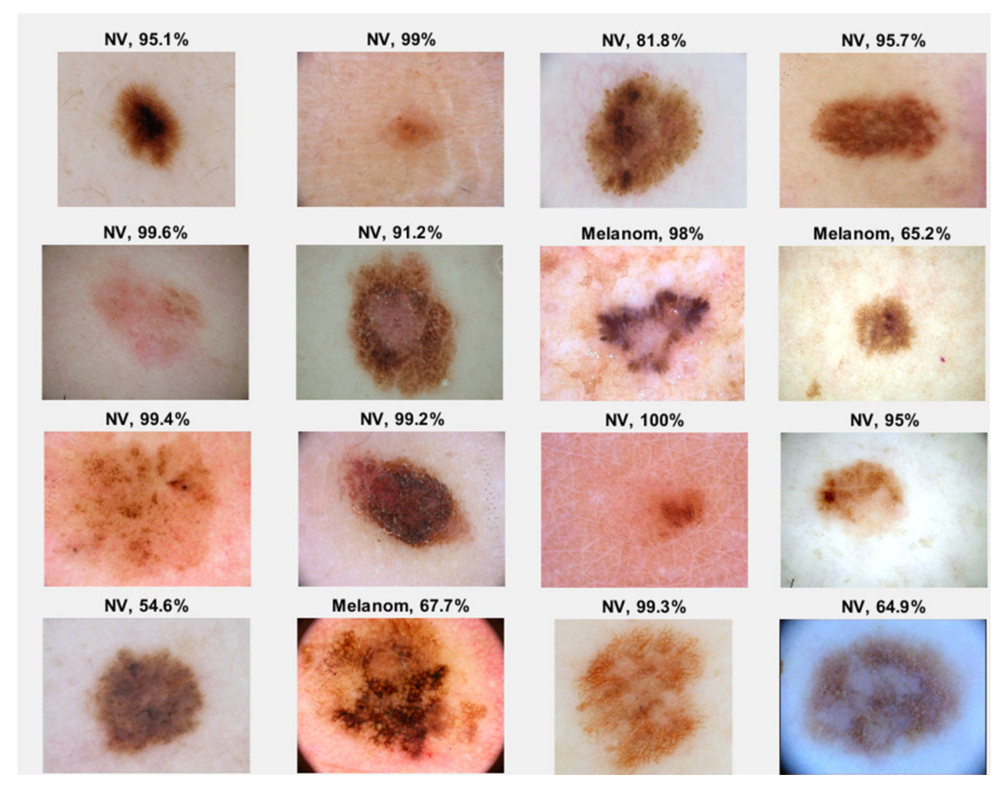 Sensors 20 01753 g021