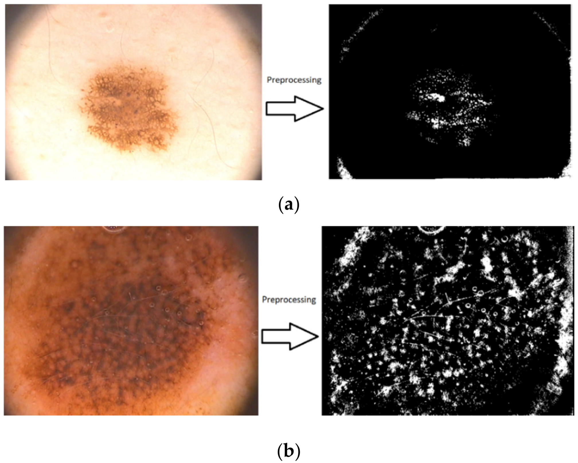 Sensors 20 01753 g028