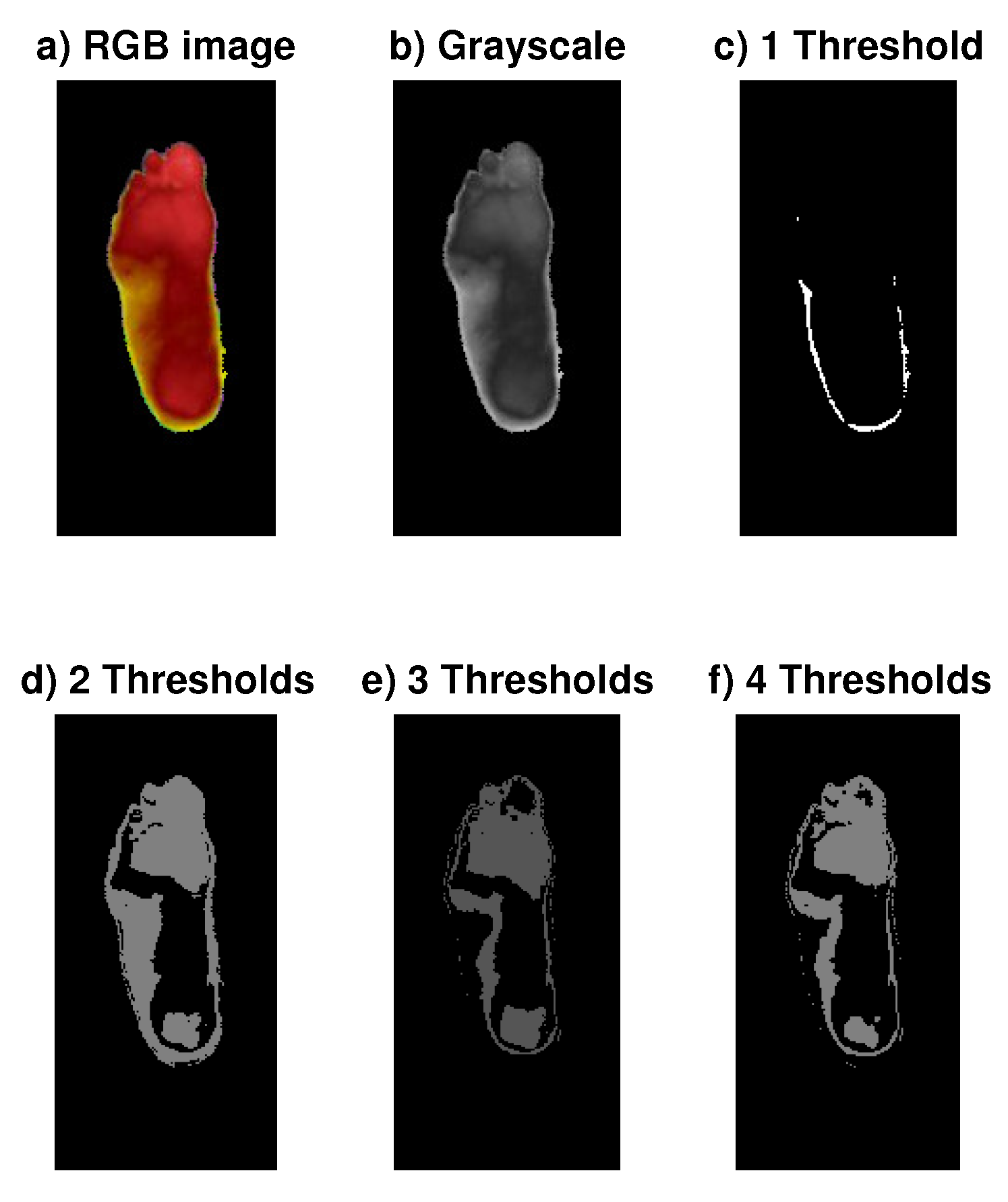 Sensors 20 01762 g004