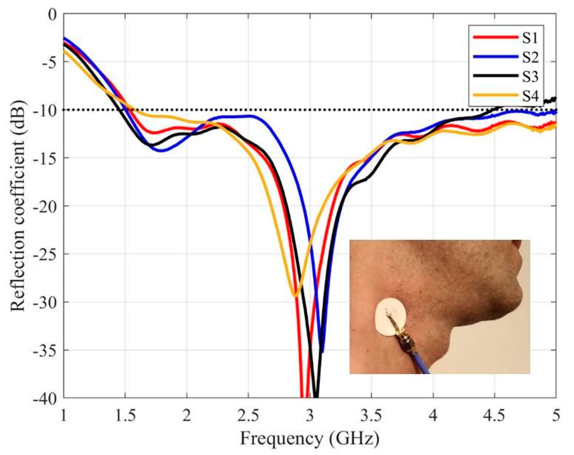 Sensors 20 01987 g007 Sensors 20 01987 g007