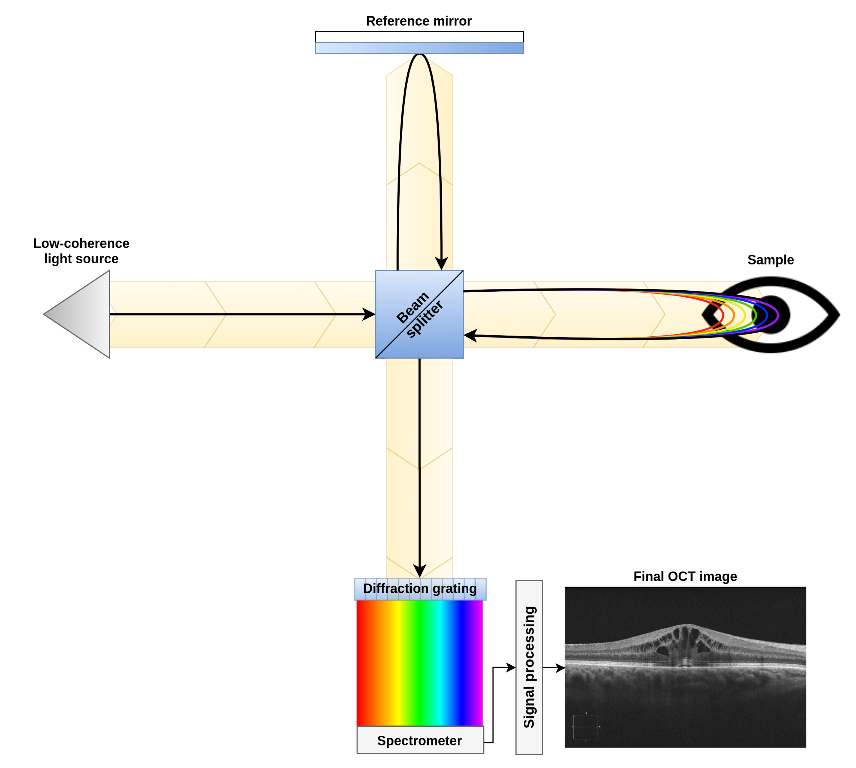 Contactless optical coherence tomography of the eyes of