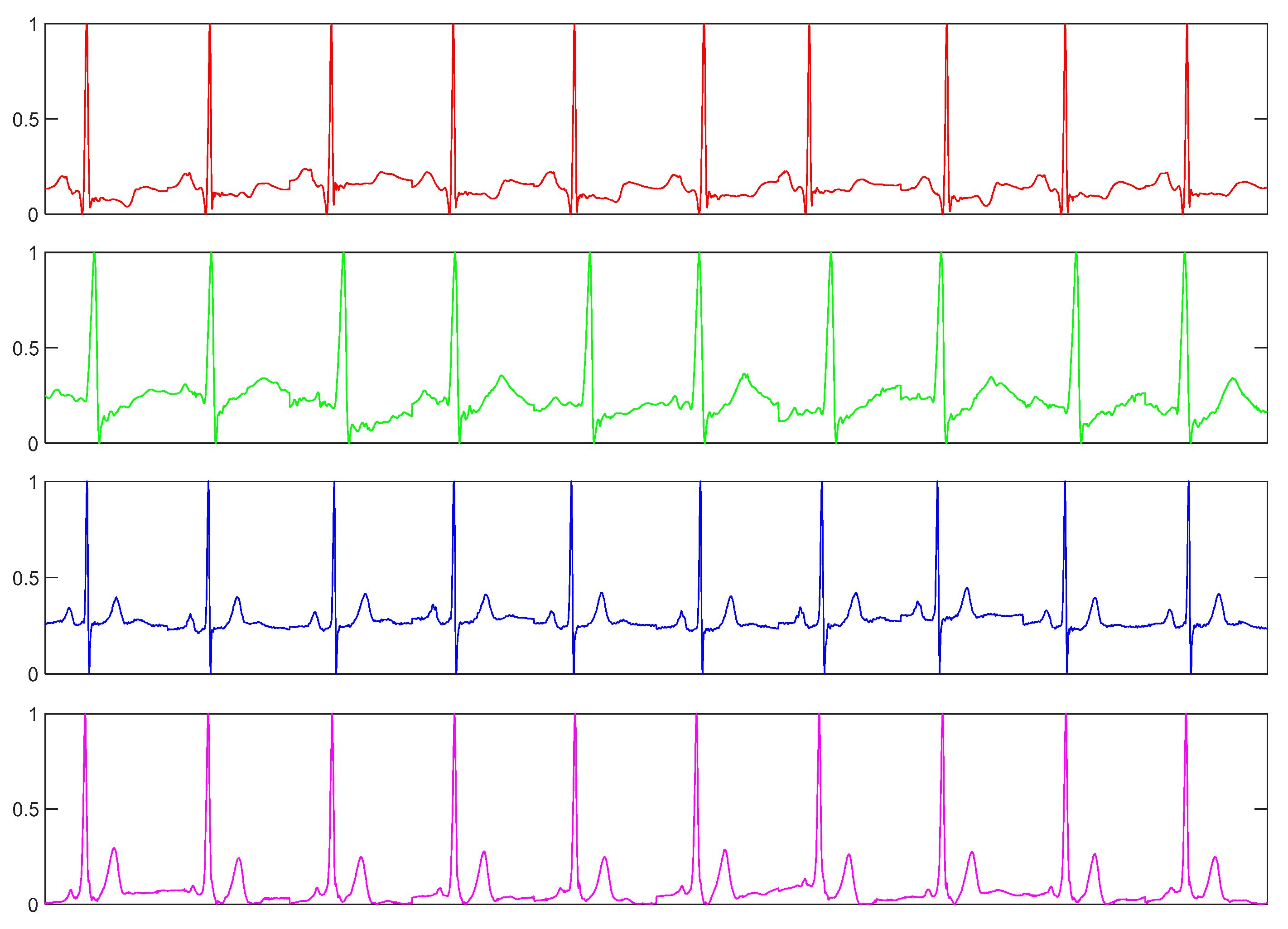 Sensors 20 02085 g010