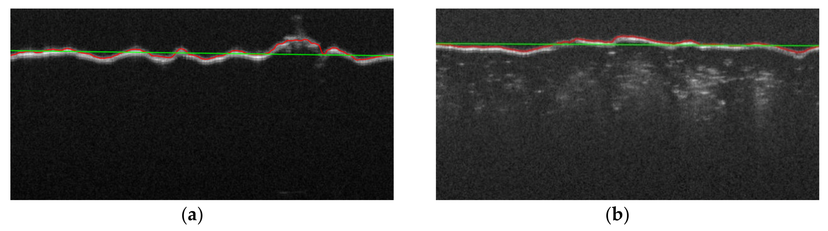 Sensors 20 02128 g008