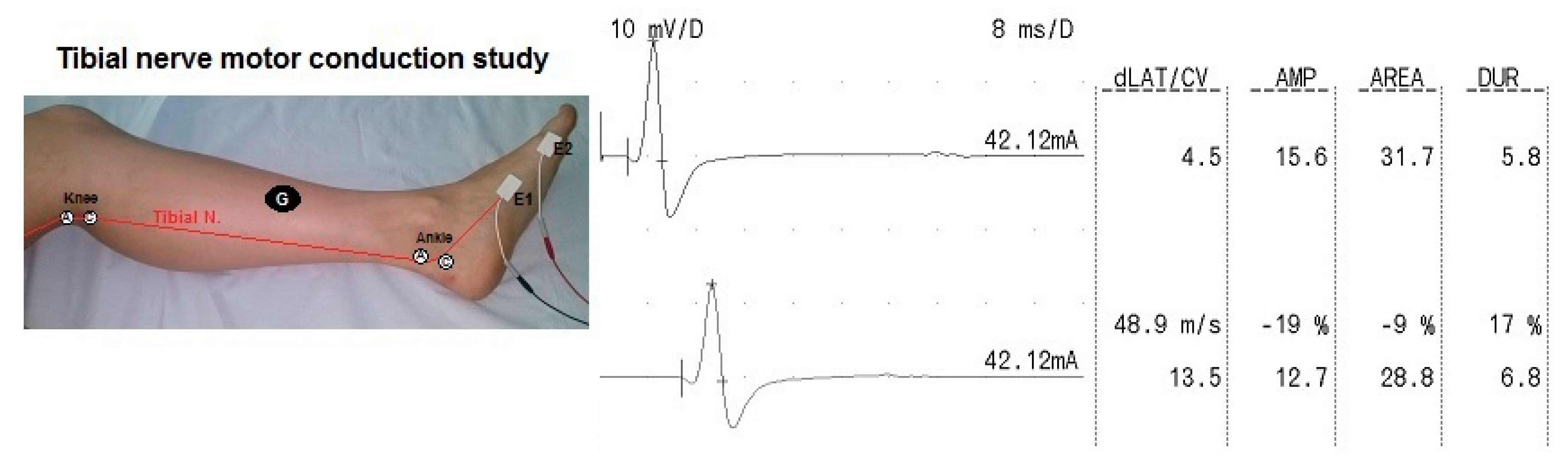 Sensors 20 02162 g003