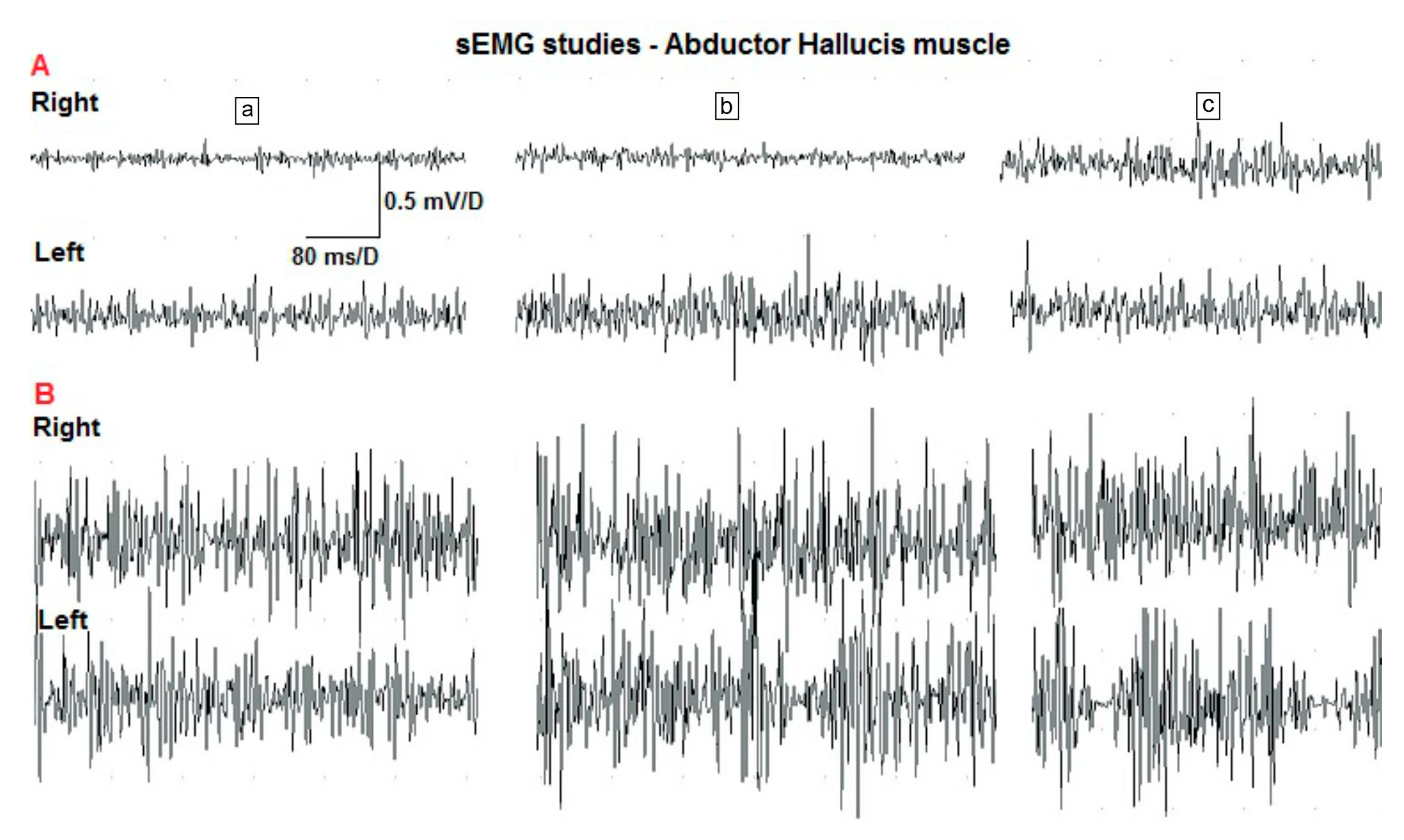 Sensors 20 02162 g004