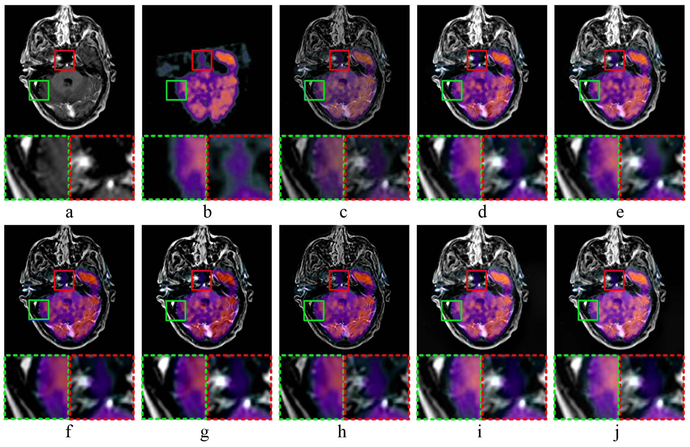 Sensors 20 02169 g006 Sensors 20 02169 g006