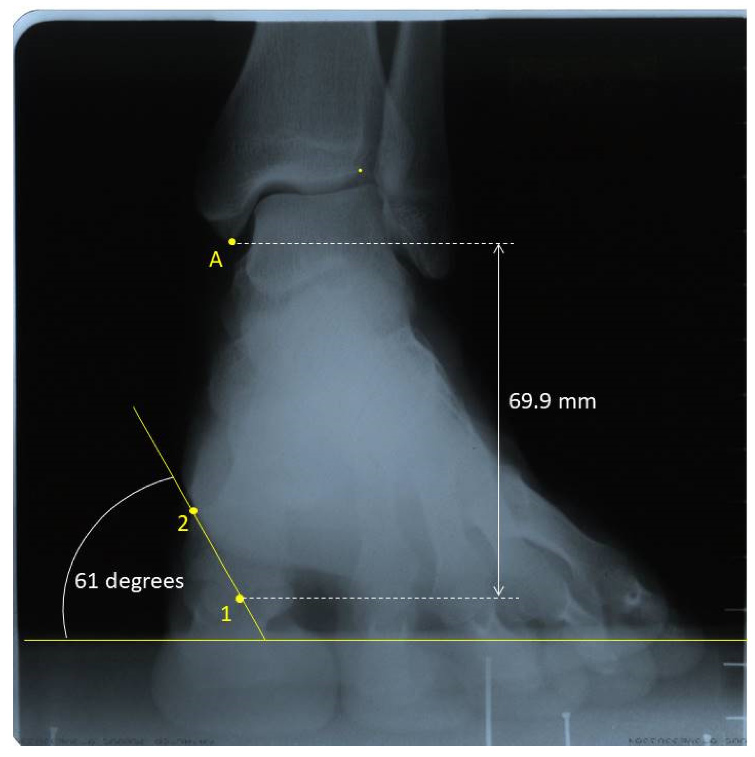 Sensors 20 02207 g003 Sensors 20 02207 g003