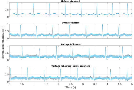 Sensors | Free Full-Text | Two-Electrode ECG for Ambulatory Monitoring