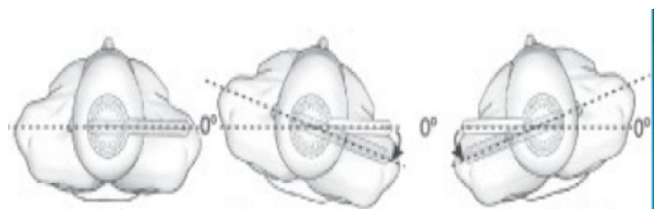 Sensors 20 02482 g002