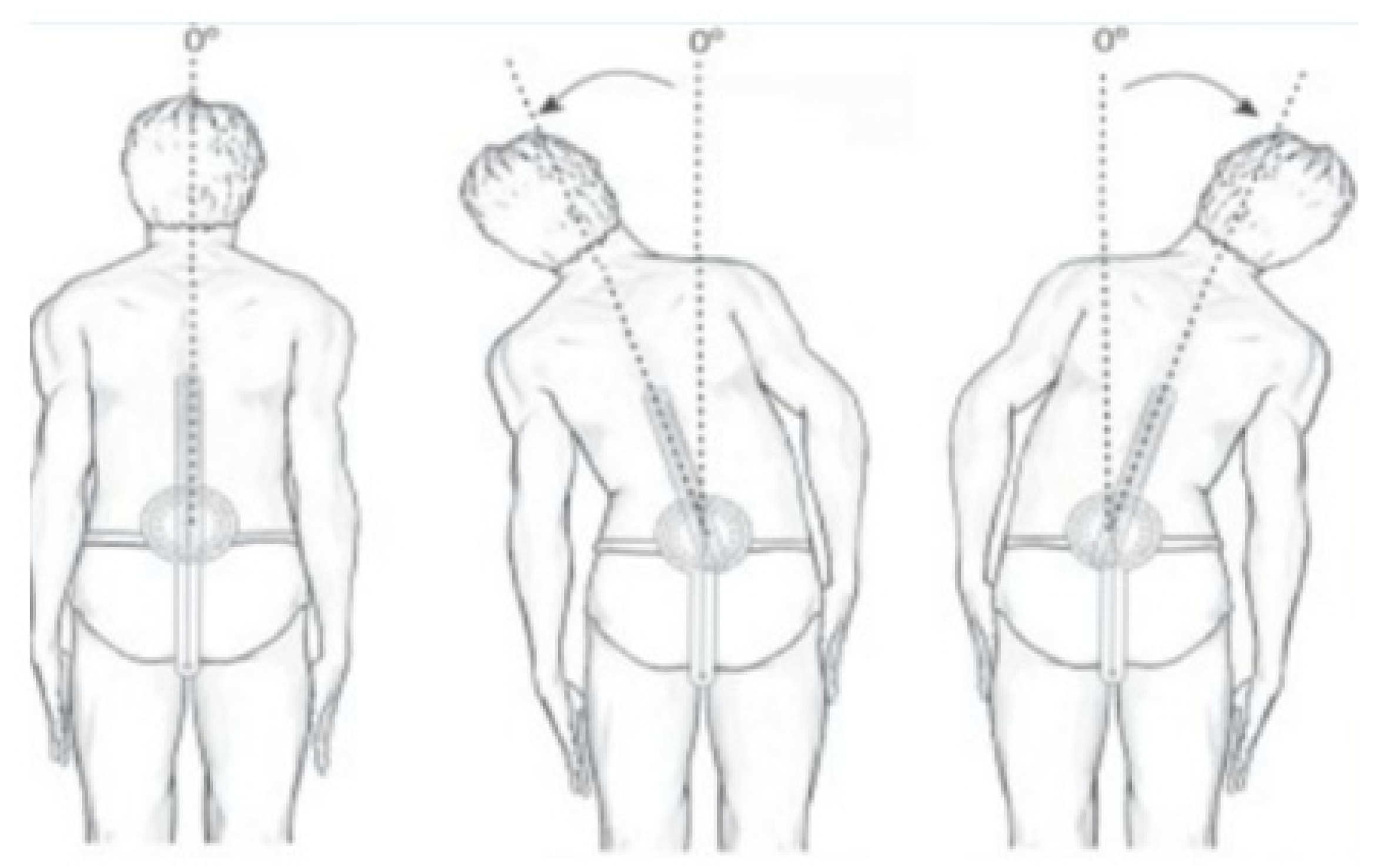 Sensors Free FullText Trunk Range of Motion Is Related to Axial