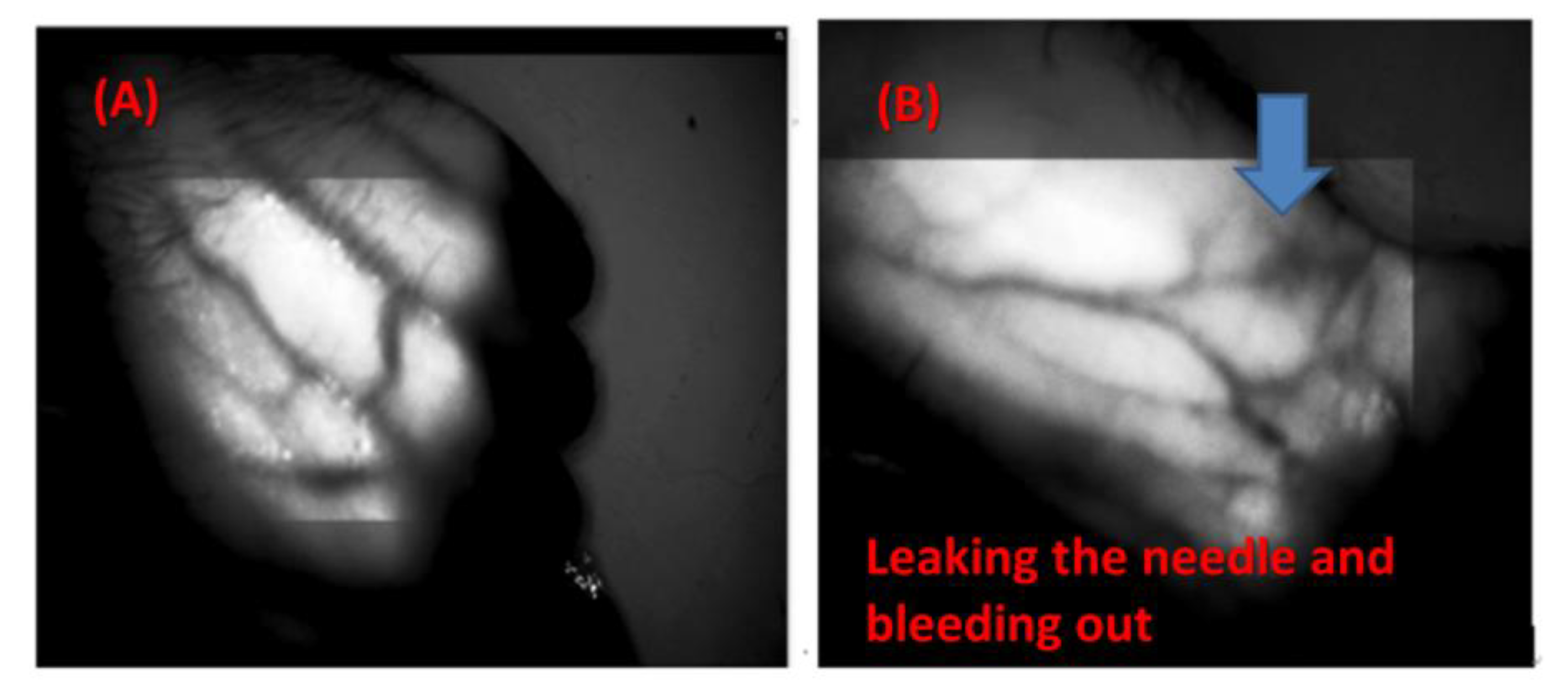 Sensors 20 02521 g009a Sensors 20 02521 g009a