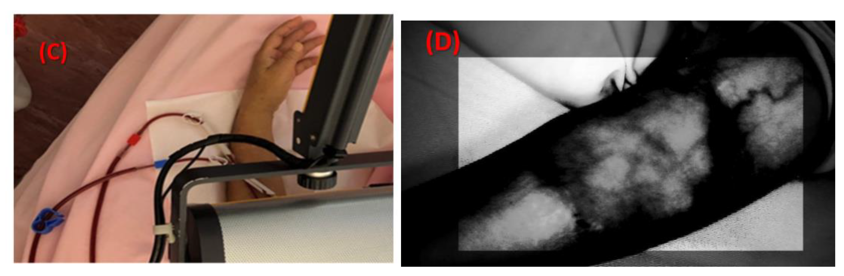 Sensors 20 02521 g009b Sensors 20 02521 g009b