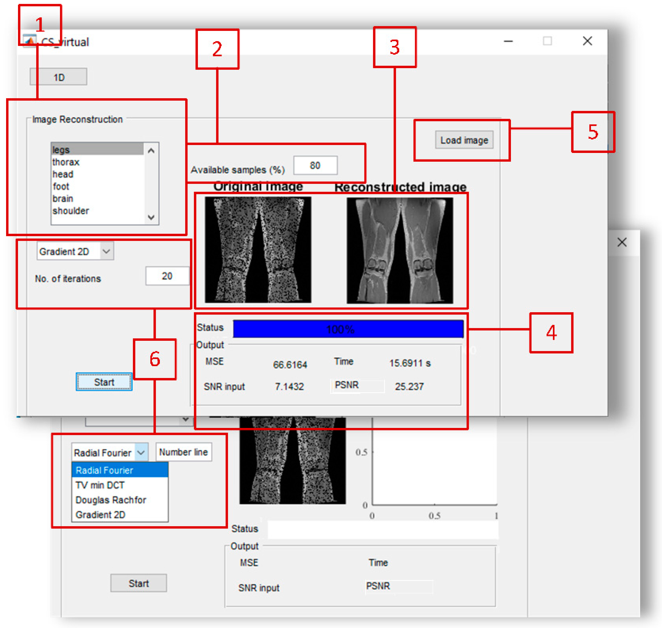 Sensors 20 02602 g004