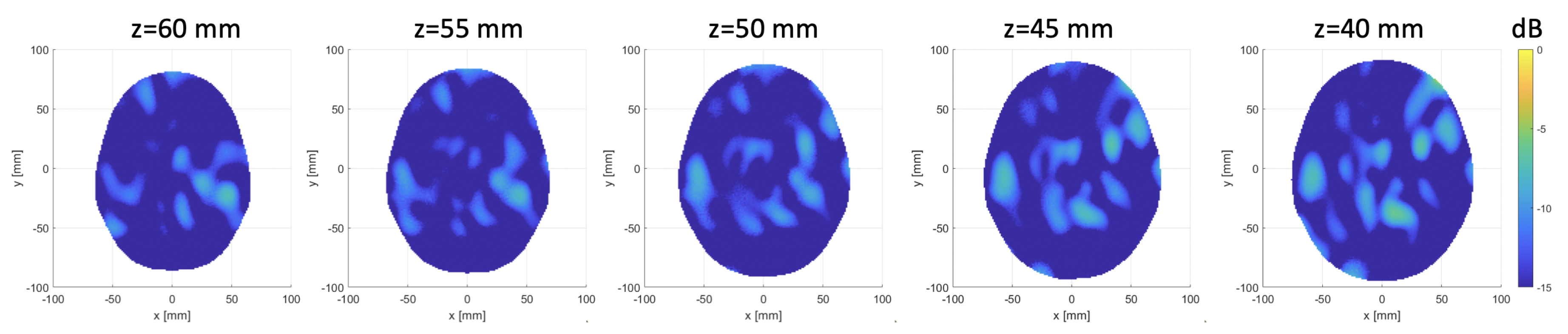 Sensors 20 02607 g012