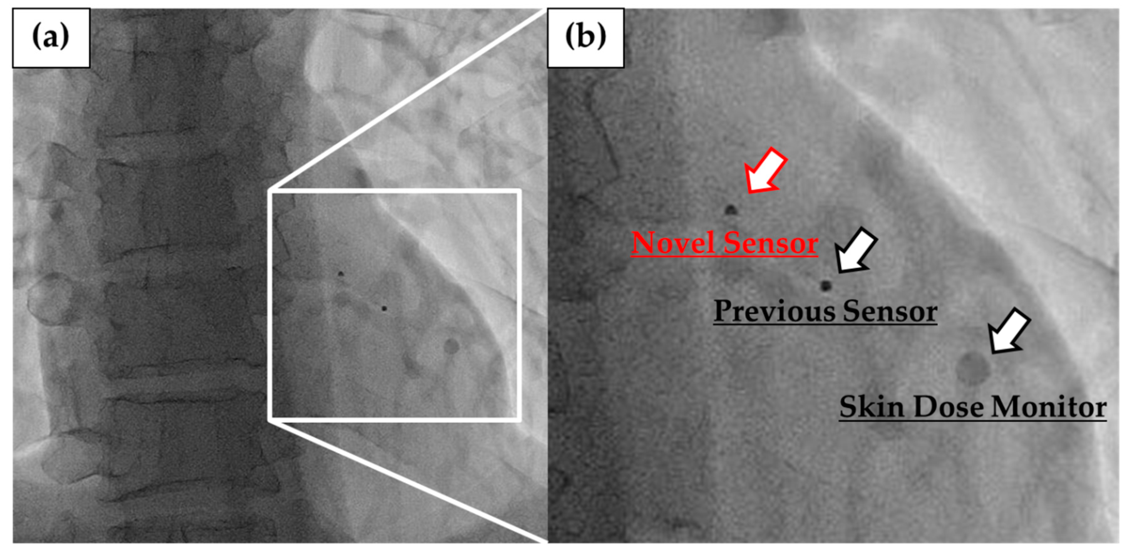 Sensors 20 02741 g011 Sensors 20 02741 g011