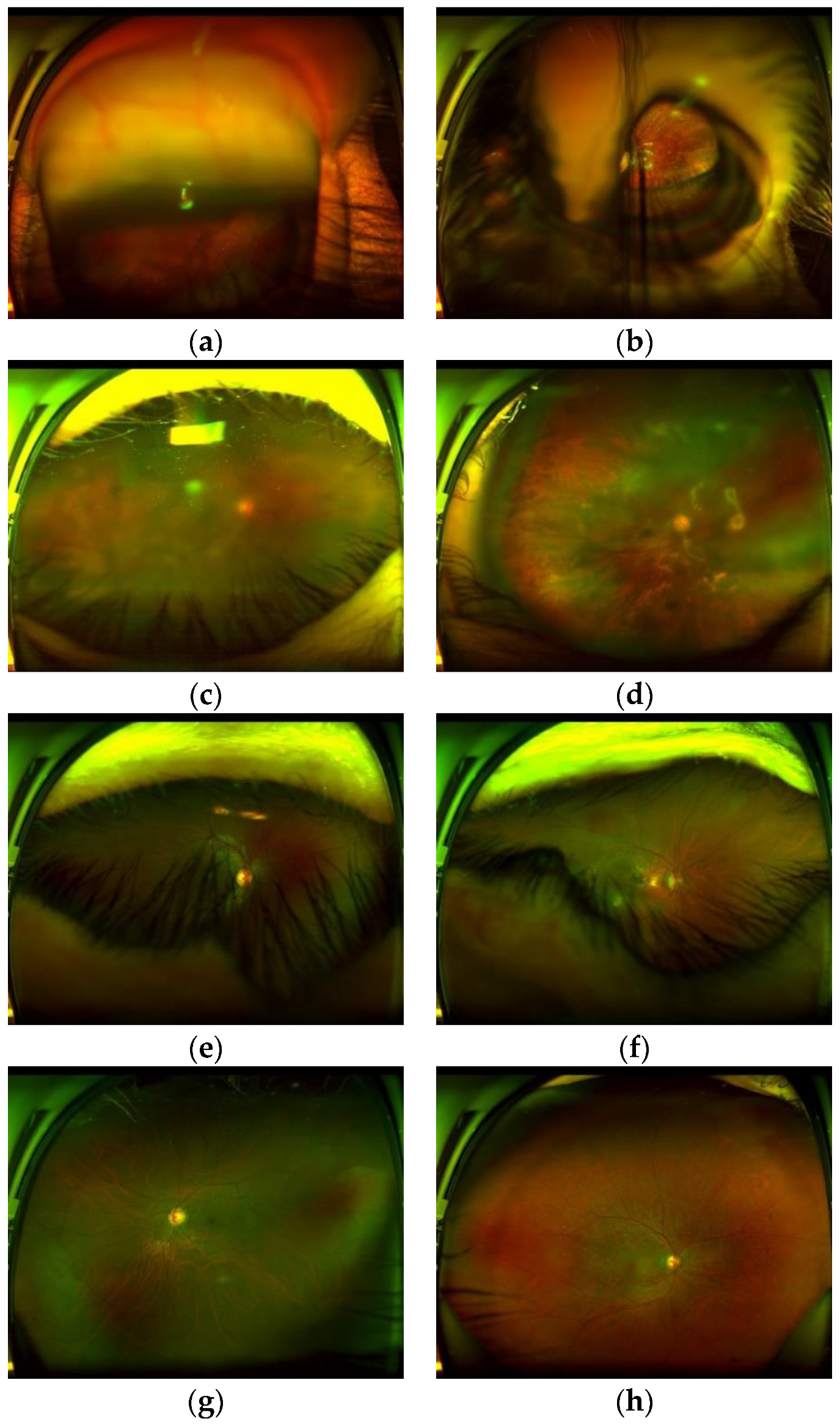 Sensors 20 02838 g001