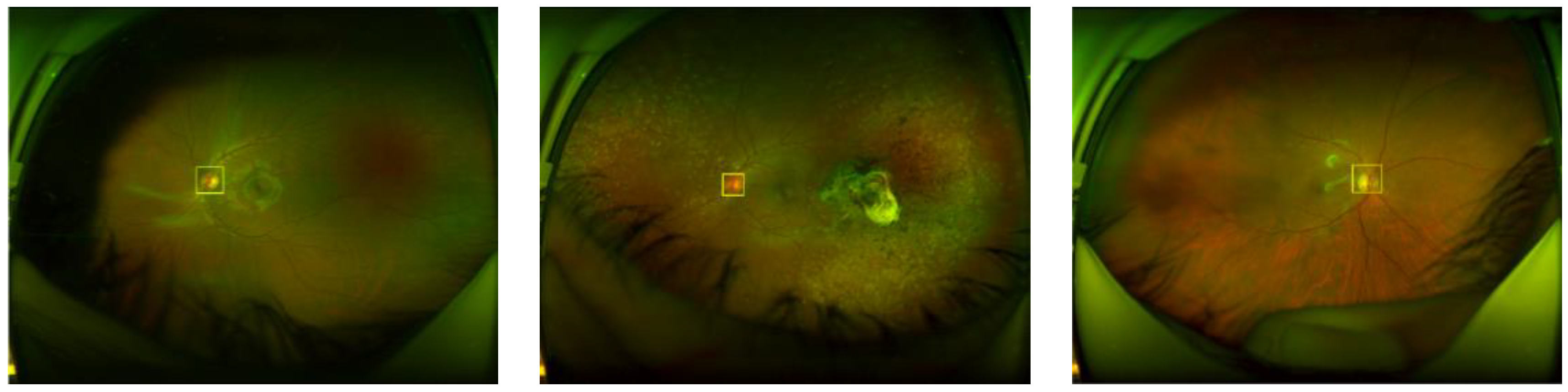 Sensors 20 02838 g004