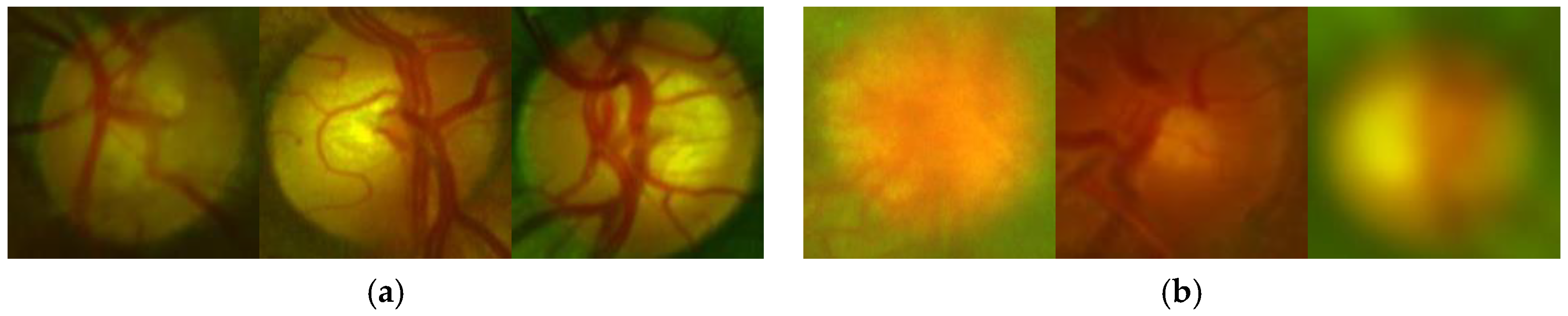 Sensors 20 02838 g006