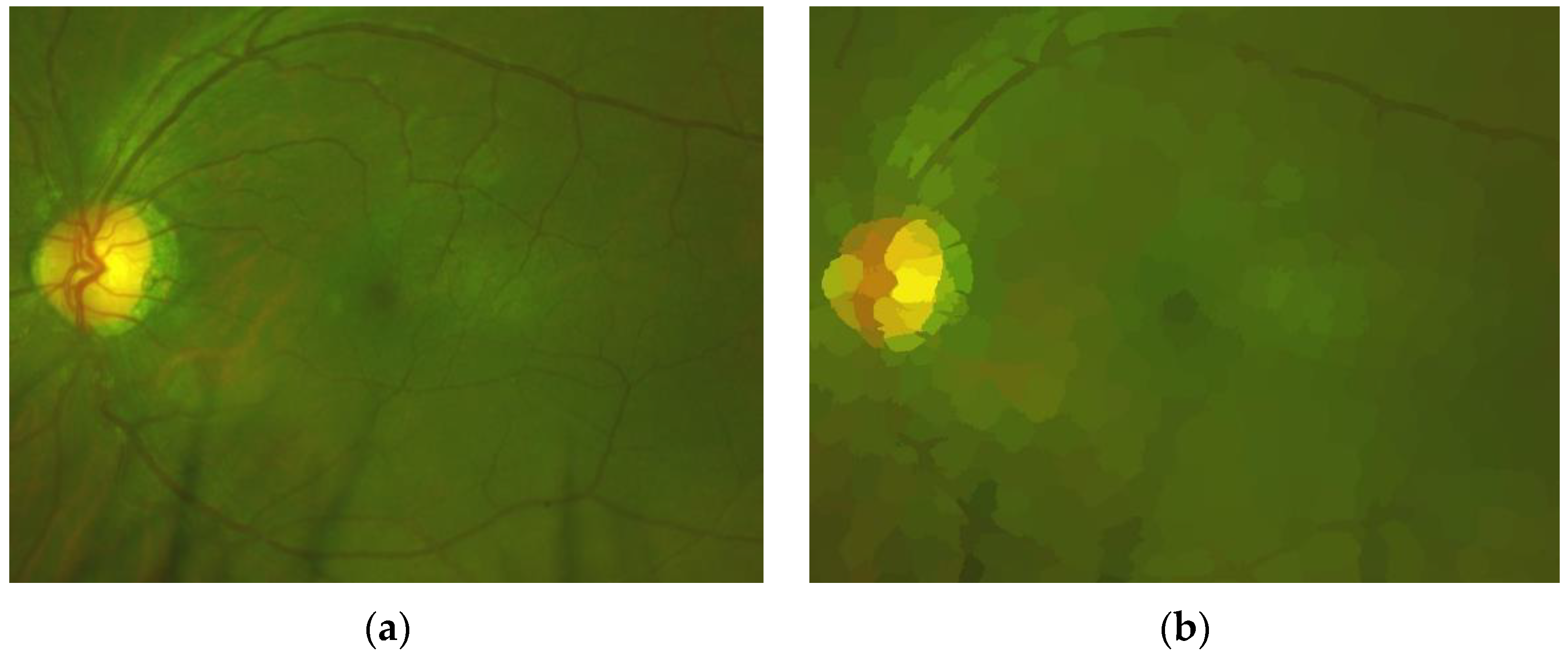 Sensors 20 02838 g008