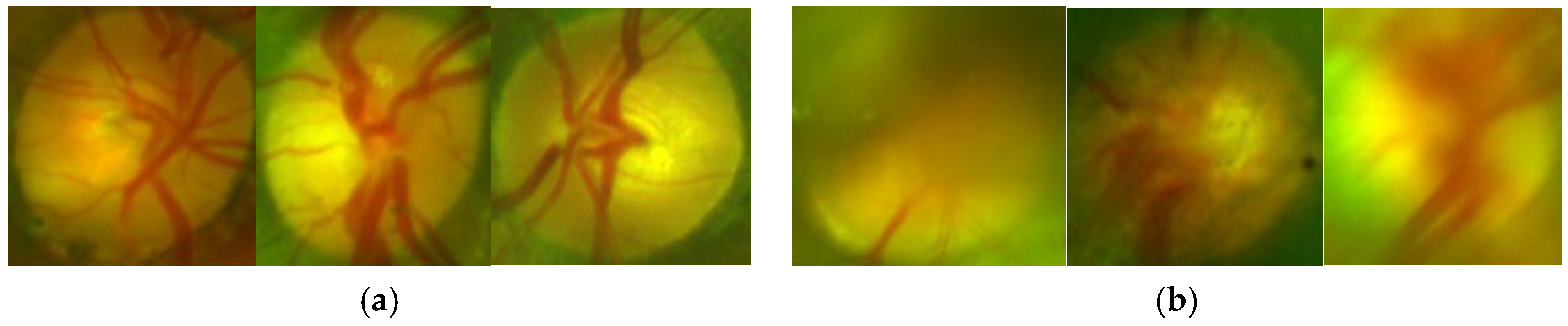 Sensors 20 02838 g012