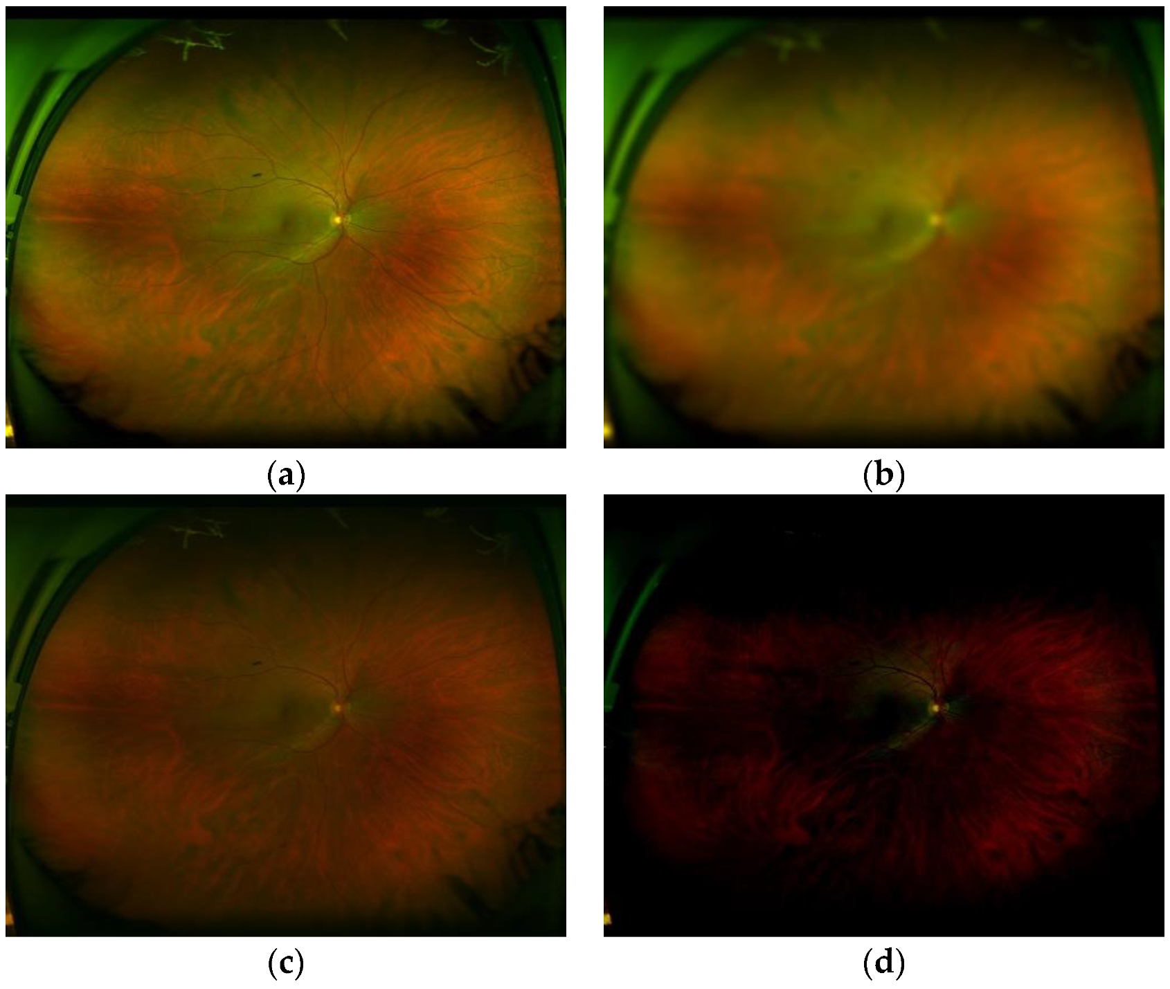Sensors 20 02838 g015