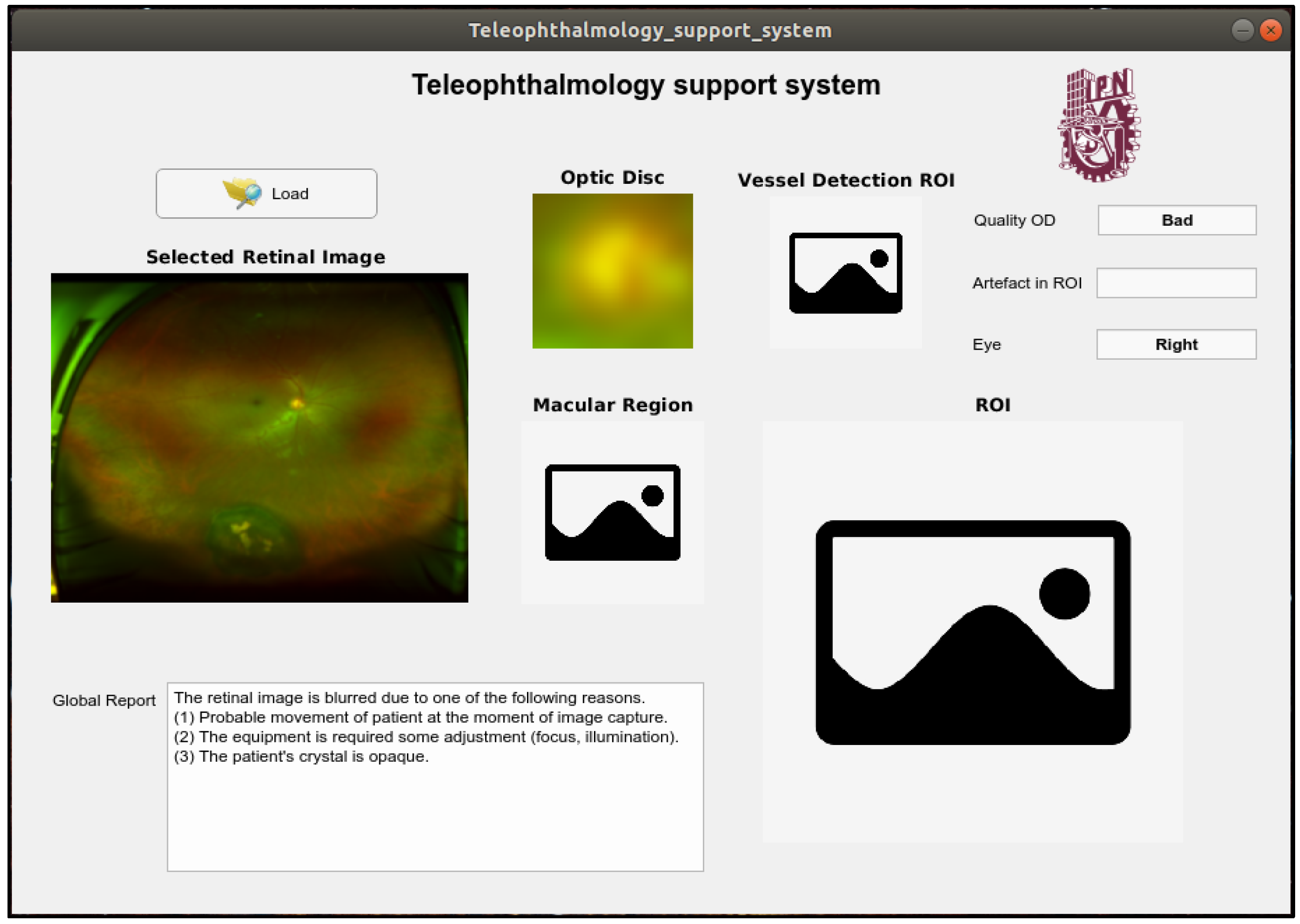 Sensors 20 02838 g017