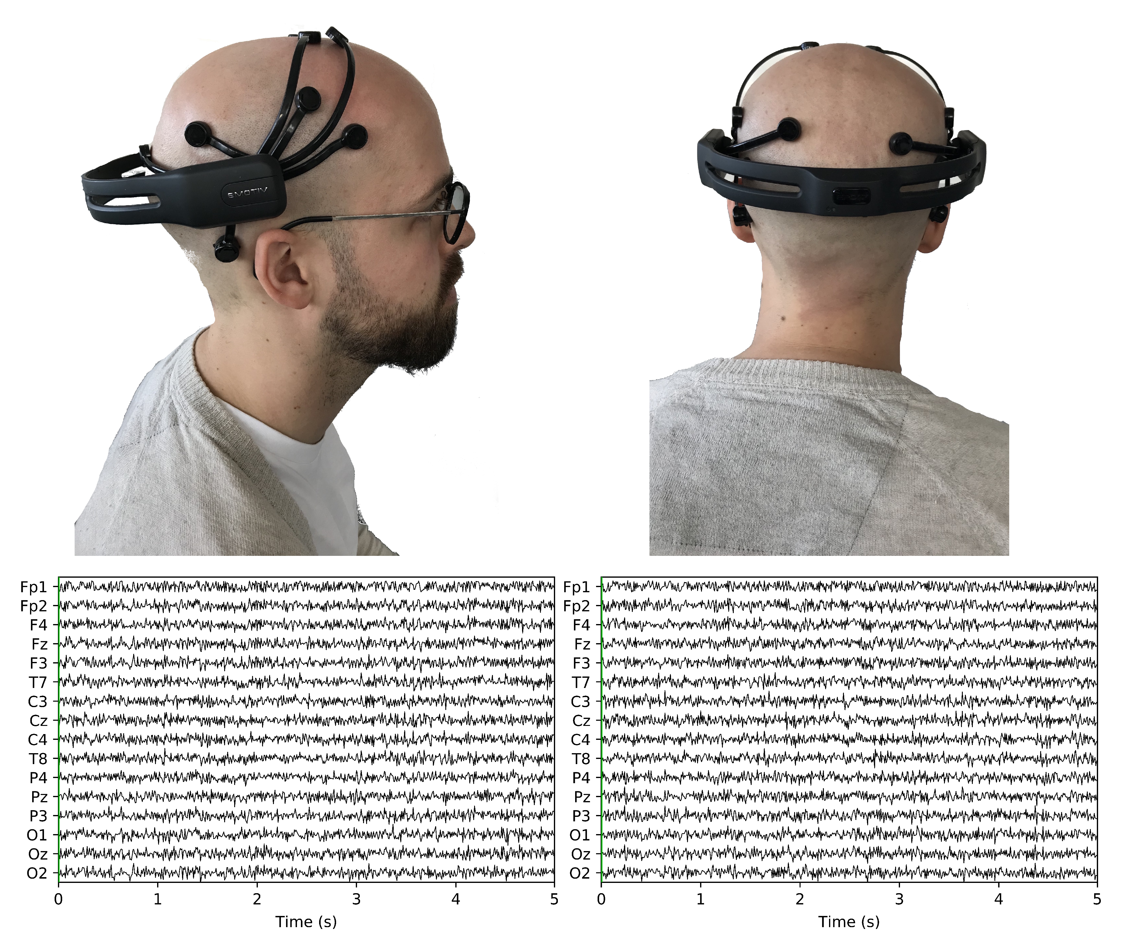 eeg sensor eeg sensor