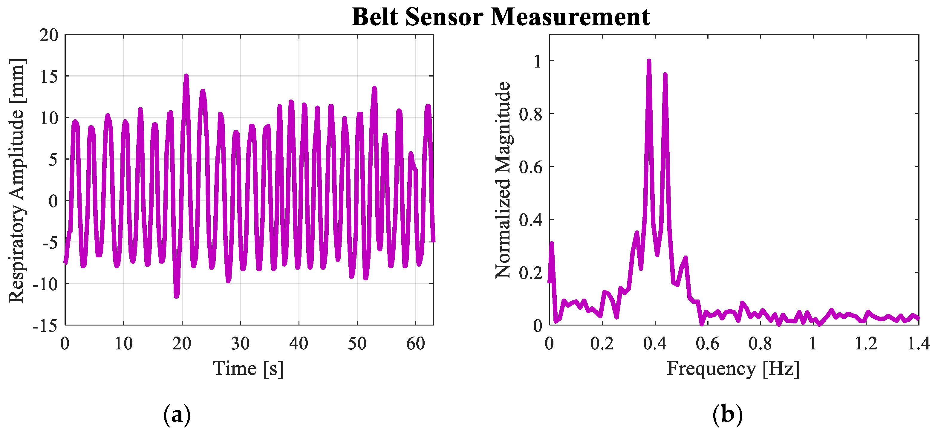 Sensors 20 02916 g011 Sensors 20 02916 g011