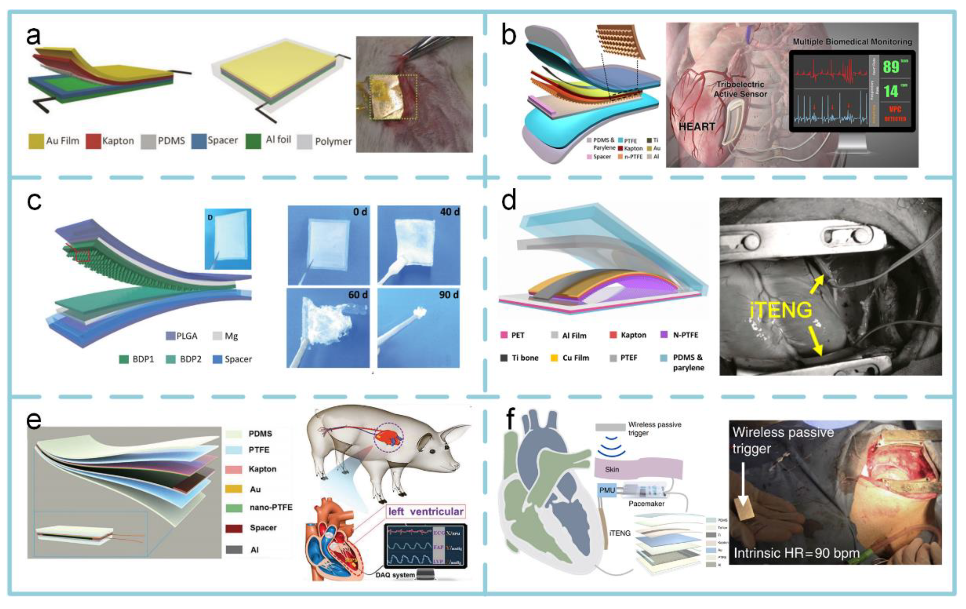Sensors 20 02925 g013