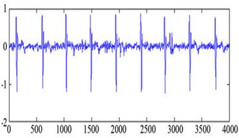 Sensors 20 02941 i011 Sensors 20 02941 i011