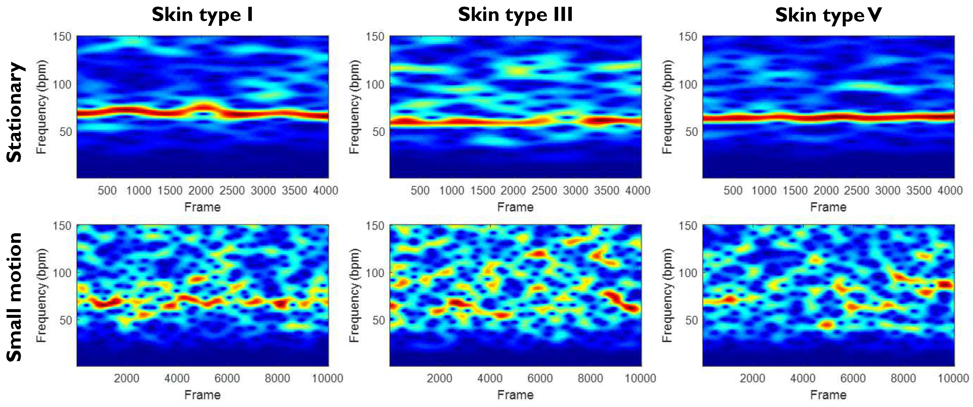 Sensors 20 03044 g003