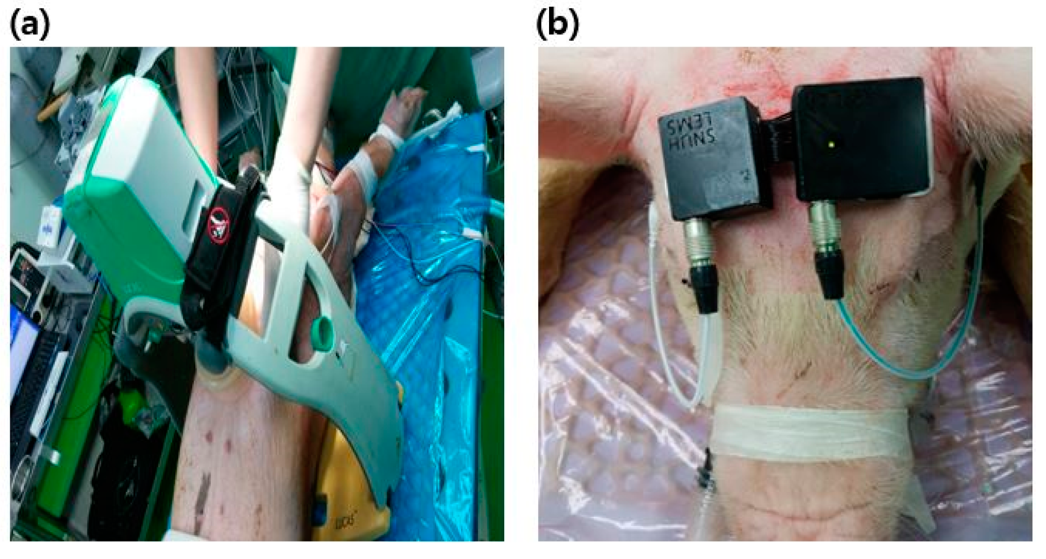 Sensors 20 03052 g001