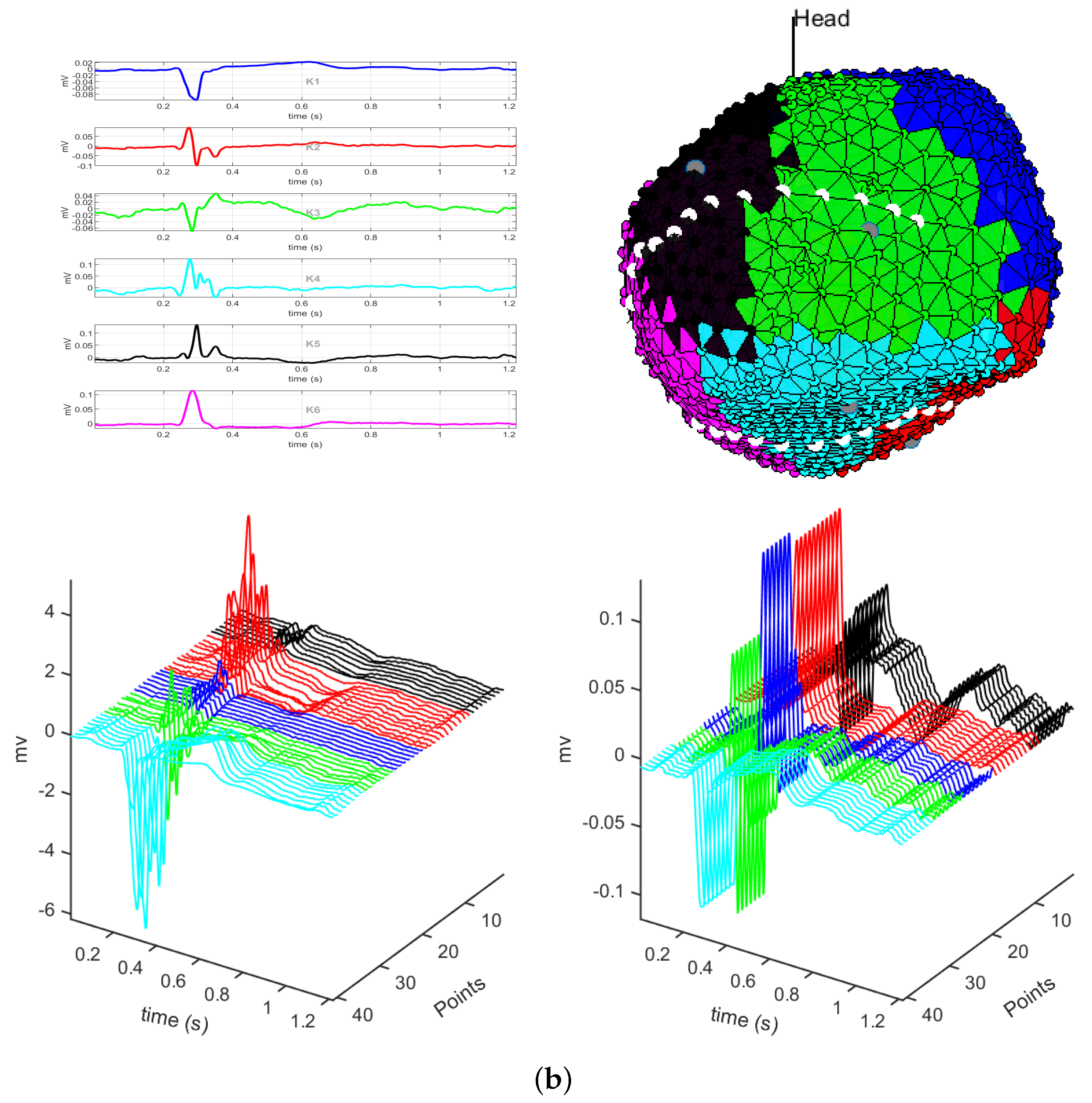 Sensors 20 03070 g003b Sensors 20 03070 g003b