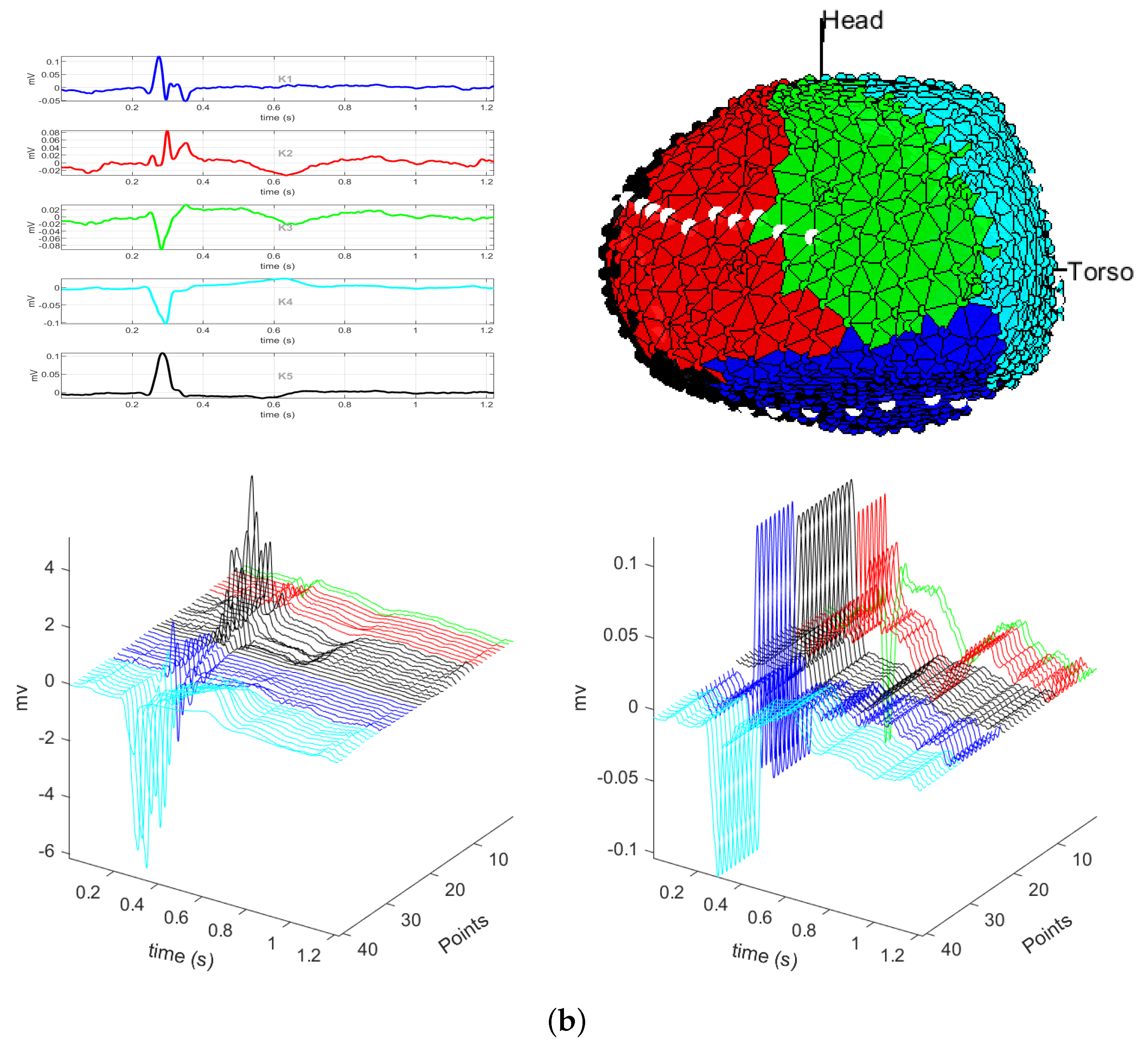 Sensors 20 03070 g004b Sensors 20 03070 g004b