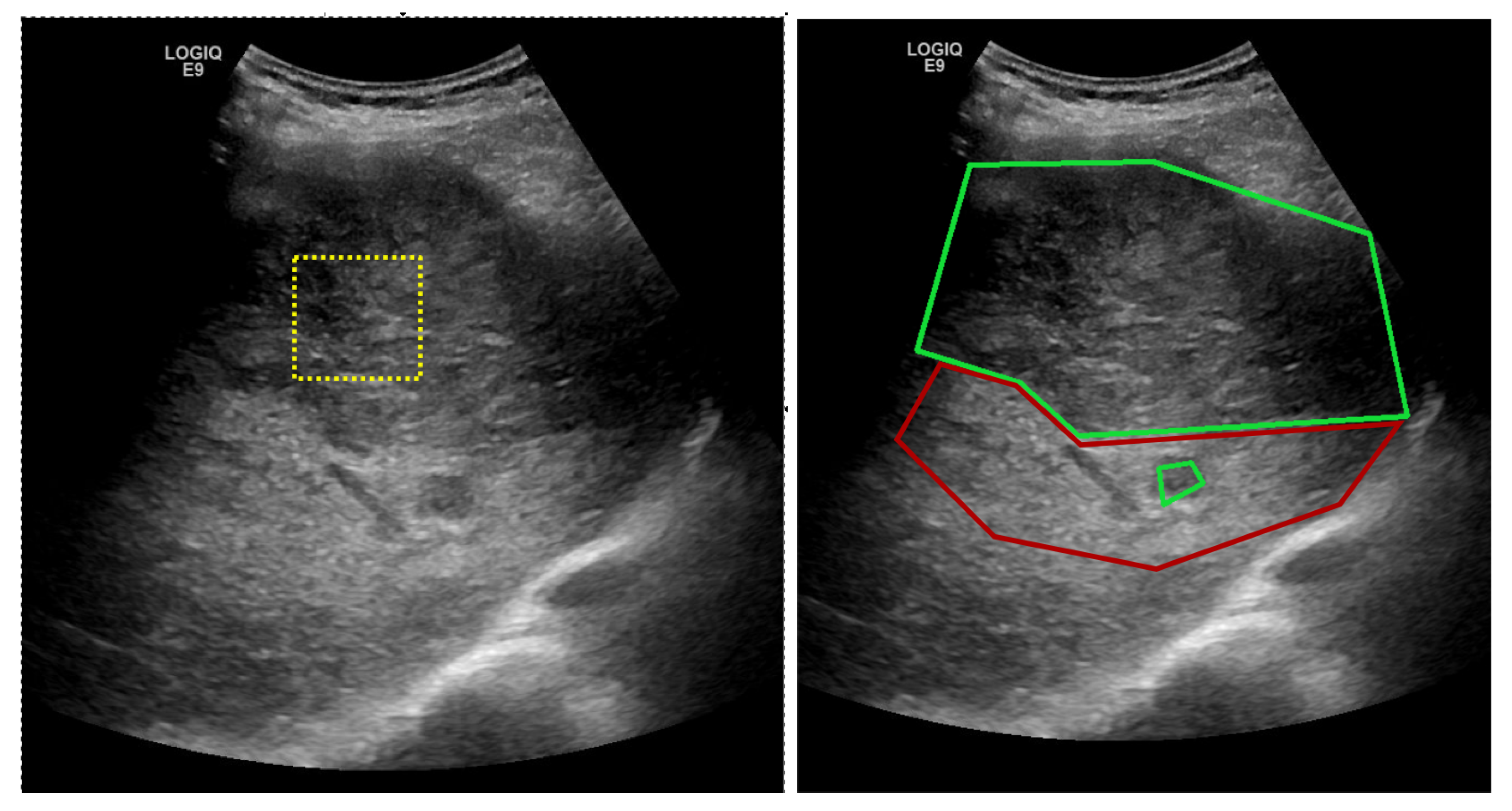 Sensors 20 03085 g001